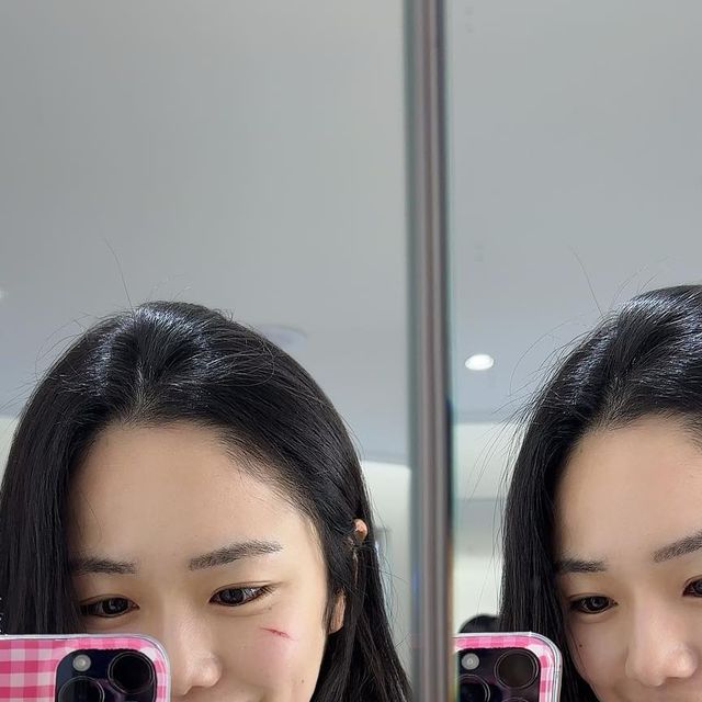 멍뭉지 🐶 on Instagram: "얼굴 붓기 빼는 법 !! 비오틱메디 EMS 마사지기로 붓기도 빼고 리프팅 탄력 케어까지 🙈 에스테틱 피부샵에서만 받던 EMS마사지를 홈케어로 가능하다니!! 얼굴 뿐 아니