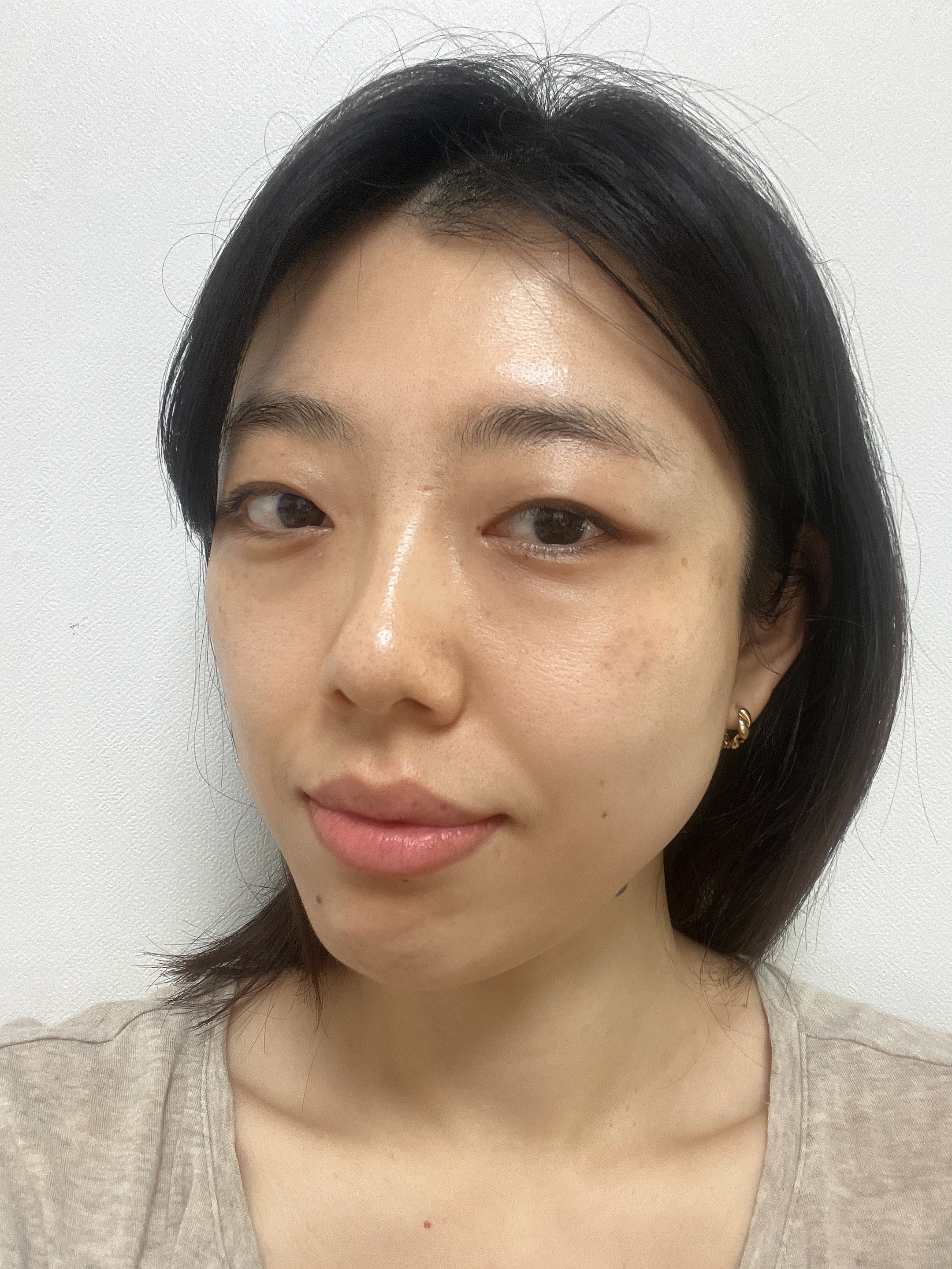 [비오틱메디] 울트라 딥 레이저크림 (기미,잡티 케어)