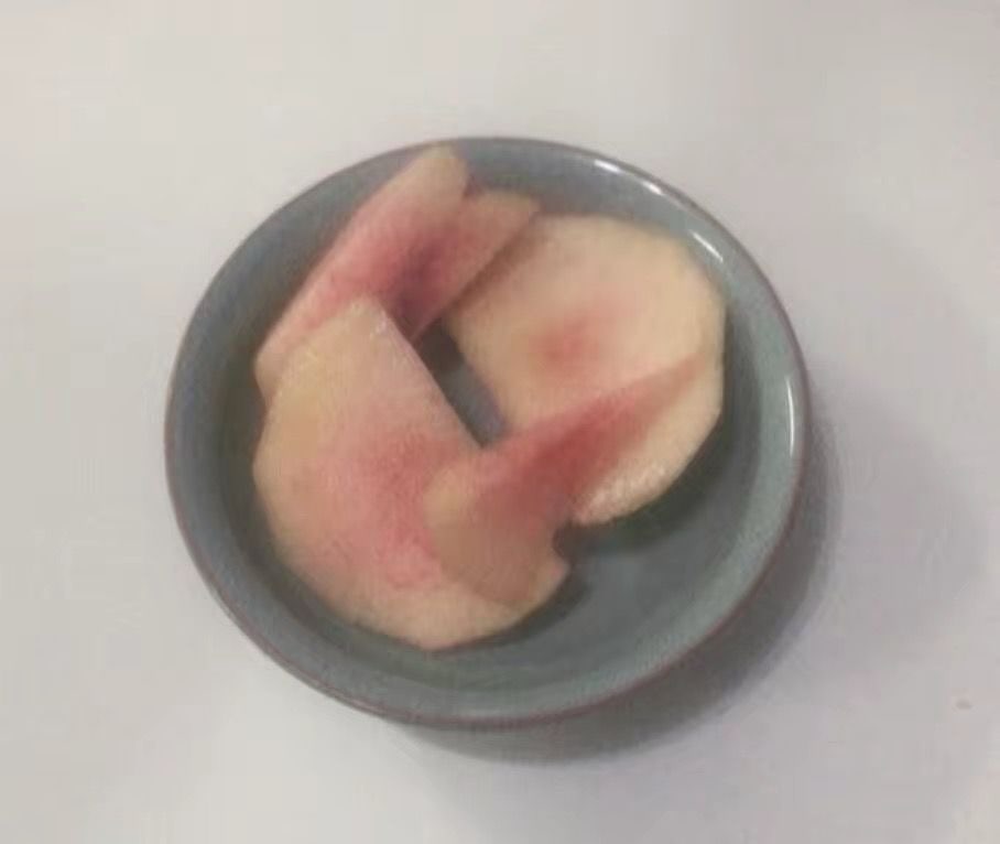 콘텐츠