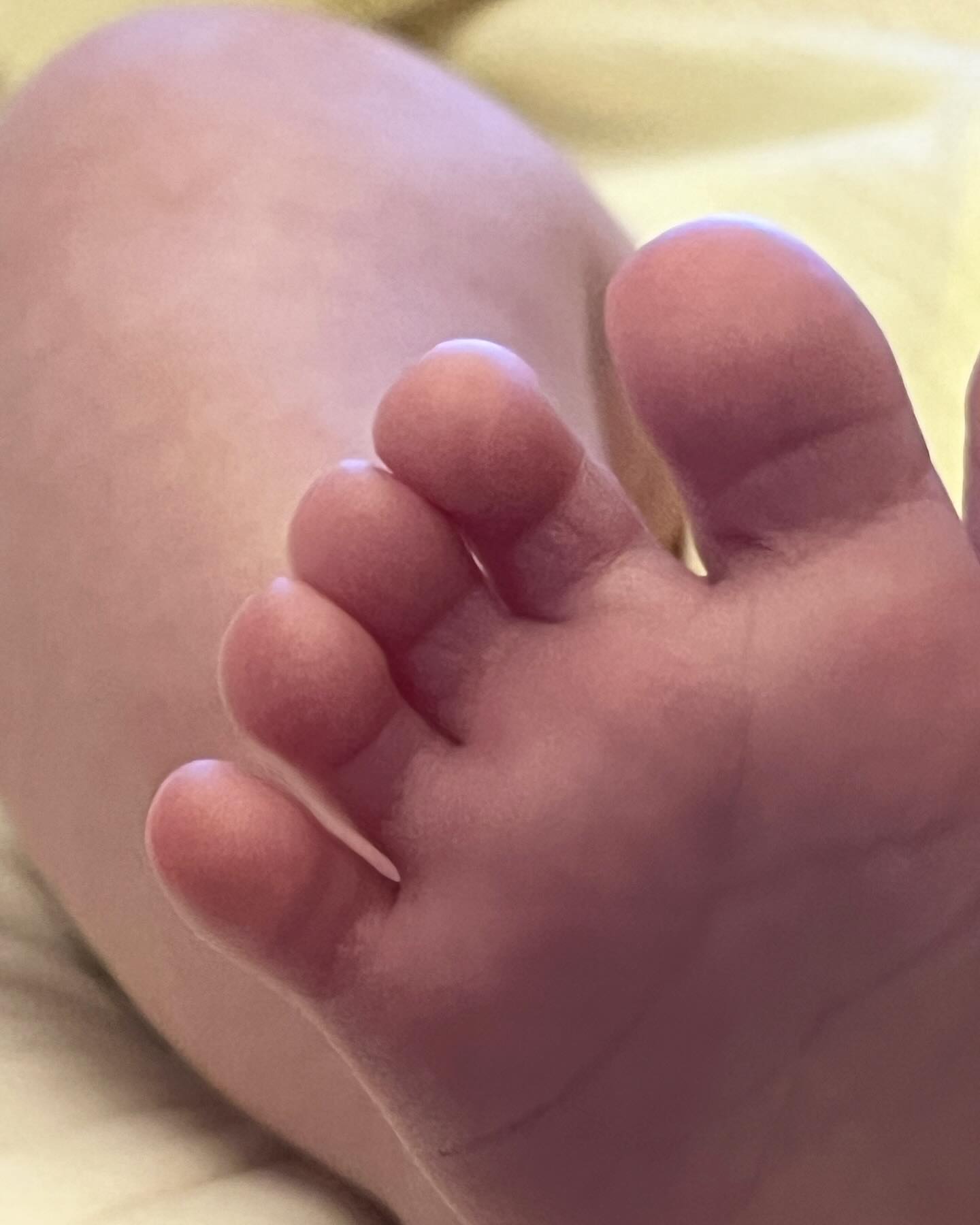 발까락은 꼭 완두콩같아서 무척 기야우 죽겟꾸 .. ꢭ
요 몇일 새벽 배앓이땜시 초보엄마는 죽을맛이구 .. (ꈨຶꎁꈨຶ)۶ 
율아 아푸지말쟈 ㅇㅏ아아 배앓이따위 이겨내ㅈㅑ아아ㅏ (제-발)🙏🏻

#신생아 #생후34일차 #육아일상 #주수기록 #배앓이그만
#배앓이 #아들맘 #토끼띠맘 #육아고민 #육아소통