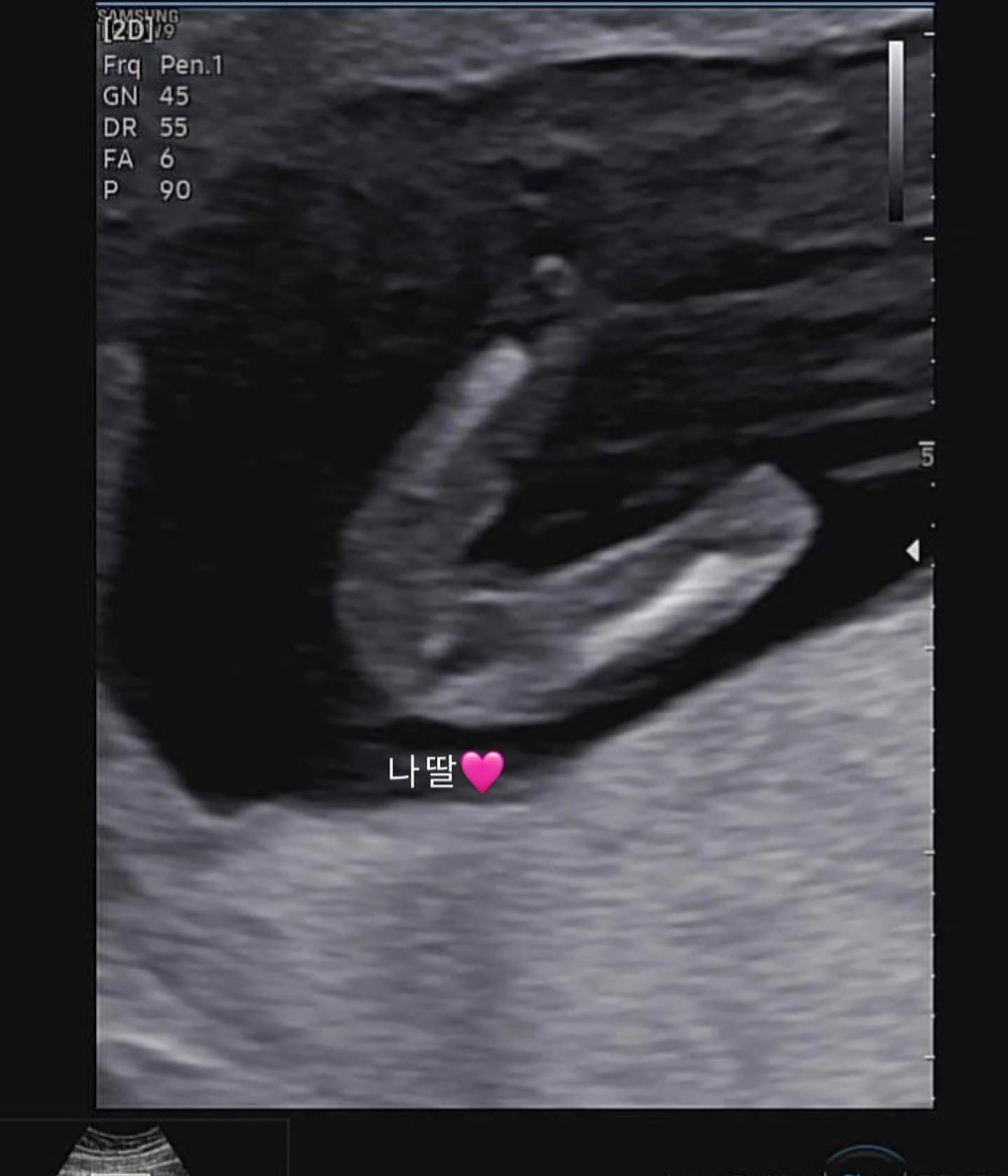 ⠀
울 집 뉴 멤버 리치예용👶🏻🍼
⠀
내가 임밍아웃 하는 날이 오다니 ㅎㅎㅎㅎ
아직 입덧체덧먹덧양치덧 지옥이지만
하고싶은건 다해야하는 MZ와이프&딸랑구&며느리로서
성별알자마자 케이크 주문하고 바빴던 연휴 전 날😁
⠀
병원 갈 때마다 뭐가 그렇게 궁금한지
의사쌤이랑 수다 떨다 오는 오빠ㅋㅋㅋ
열일하구 집오면 주부로 사느라 고생이 넘 많지만
앞으로도 더 잘 부탁해^^
⠀
울 애기 3월에 건강하게 만나쟈♥
