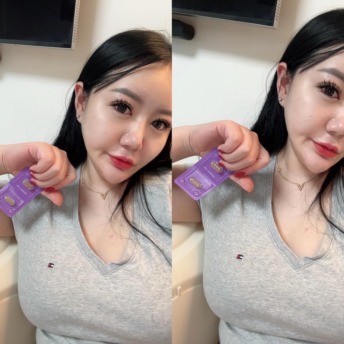 #협찬 

요즘 핫한 하루두알다이어트 🫶🏻
가지고다니기도 좋고, 먹고나니 화장실듀 잘가서 넘 좋음! 
내돈내산후기도 많아서 믿음직스러운 워너버닝다이어트알파! 
용량도 4주분으로 든든하다구용 ⸜(♡ ॑ᗜ ॑♡)⸝ 
요즘 너무 살쪄서 스트레스받는데 워너버닝으로 열심히 다욧 해보겠다용 !!! 🙊

#워너랩 #워너버닝다이어트 #다이어트보조제 #2주다이어트 #아이돌다이어트 #맞팔 #선팔 #셀피 #일상 #몸바디 #눈바디 #diet #selfie #instagood #instadaily #instalike