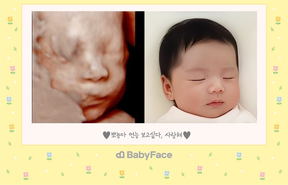 #베이비페이스 #입체초음파 #이름정하기 

후후 베이비페이스 비싸서 안할까하다가
첫째니까 한당,,,^^ㅋㅋㅋㅋ

남편 신생아때랑 똑닮았다는데
역시 첫째딸은 남편을 낳는다더니,,,🤣

이름은 시은이와 서윤이가 많았는데
빵세네 부부는 서윤이로 정해따!

친정아부지가 우리 이름도 지어주셨는데
뽀뇽이 이름도 뜻깊게 ❤️

그래도 아직은 뽀뇽이라 부를랭,,히히
세달뒤에 서윤이라고 불러줄게 뽀뇽아🫶🏻

#임산부 #임산부그램 #청룡아기 #빵세네부부 #남편똑닮