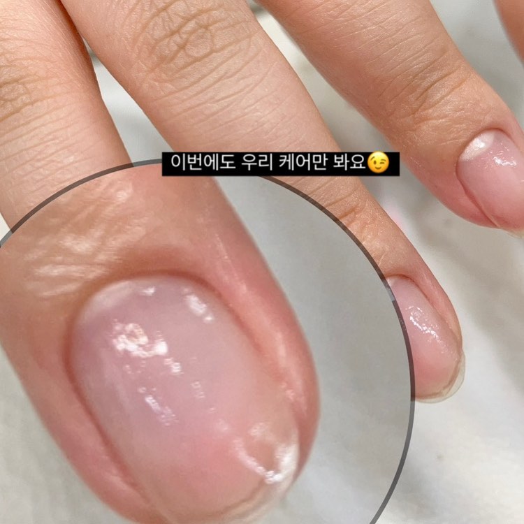 : ʀ,ʙᴇᴀᴜᴛʏ#

건강한손톱만들기 NO.2💙

예약문의 카카오채널 (프로필링크) 🕊

* 。 • ˚ ˚ ˛ ˚ ˛ • 。* 。° 。* 。 • ˚* 。° 。* 。 • ˚

▫️ 전체연장 8만 이벤트 ▫️
▫️ 연장은 추가시술입니다▫️

* 。 • ˚ ˚ ˛ ˚ ˛ • 。* 。° 。* 。 • ˚* 。° 。* 。 • ˚

👐🏻시술중에는 메세지나 전화 확인이 안됩니다. 
양식에 맞춰 카톡 남겨주시면 순차적으로 답장해드려요.
⠀
ෆ일요일휴무ෆ
⠀
🖤예약양식🖤
✓성함 (회원권 여부)
✓휴대폰번호
✓날짜와 시간
✓젤제거 여부
✓시술 할 디자인 사진
⠀
𖤐 예약금 20.000원 𖤐
𖤐 예약시간 일주일 전 취소, 변경 가능(예약 일주일 이후 취소, 노쇼 예약금 환불 불가) 변경은 예약일 제외 5일전 1회만 가능합니다. 이전 변경은 재 예약 해주셔야 합니다.
𖤐 예약시간 15분 지연시 아트 시술 불가하며 20분 지연시 자동 취소 되시고 예약금은 환불 불가 합니다.
𖤐 회원권 고객은 취소 시 20.000원 차감 됩니다.