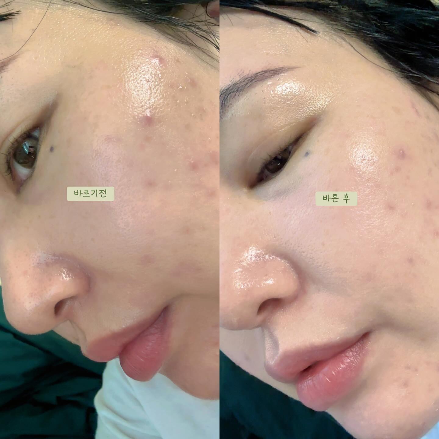 날씨가 더워지면 화장하는 여성분들은 많이 바르기 부담스럽고, 그렇다고 선크림만 바르고 나가긴 좀 너무 민낯이라 … 고민이죠!
이럴때는 예뿌게 피부보정되는 톤업크림이 절실한데 제가 요즘 사용하는제품 소개해볼께요-
 

나인위시스 제품들은 촉촉하고 사용감이 참 좋아서 인위적이지 않고 피부톤을 예쁘게 톤업시켜주는데, 요 톤업크림은 특허받은 프리미엄 식물성 성분과 온천수가 함류되서 피부톤업에 영양까지 챙길수 있어요.

톤업크림하면 백탁같이 하얗게 뜨고, 퍽퍽한 발림성때문에 꺼려졌는데 펴발릴때의 질감이 뻑뻑함없이 촉촉하게 발려서 수분감이 느껴지는 제품이였어요.

파운데이션이나 팩트사용하면 아무리 안묻어나는 파운데이션이나 팩트라도 마스크에 어느정도는 묻어나는데, 나인위시스 톤업크림은 마치 생얼에 마스크를 썻던것처럼 묻어나옴도 없더라구요!

이번에 쿠팡기획셋트로 50ml에 여행용으로 30ml 추가증정도 되서 저는 이번 상해여행에 요 여행용 챙겨 가려고 합니다. 

바르면서 미백 주름개선 영양까지 -
백탁이 생기거나 들뜨지도 않는 프리미엄 톤업크림으로 파데프리 꾸안꾸 생얼 메이크업 해봐요:)

#제품제공 #나인위시스 #데일리메이크업 #수분폭탄 #메이크업베이스 #vb프리미엄 #톤업크림 #톤업크림추천 #스킨케어추천 #뷰티 #beauty 
#skincare #makeup 

쿠팡기획셋트 링크 
https://link.coupang.com/a/bAnJCn