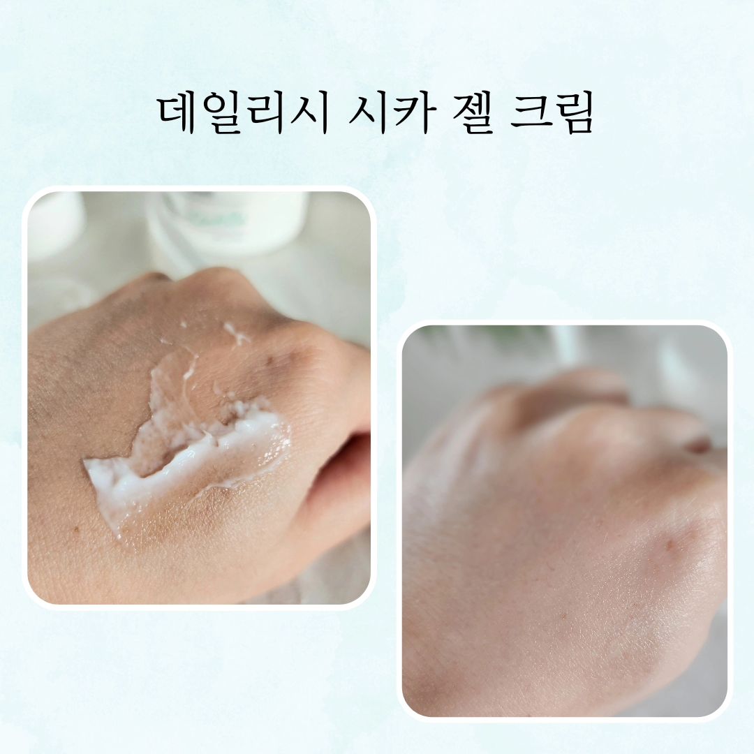 #협찬 

한달에 한두번씩은 꼭 트러블이 올라와서 고민하게하는 
나의 피부.
트러블피부를 진정시켜주는 시카케어 젤 크림이예요.
발라보면 수븐감이 아주 좋아서 하루종일.촉촉한 느낌!!
수분감은 지켜주면서 피부의 번들거림은 방지해주는..
내가 찾던 그 크림이예요.

세안후 토너 사용하고 
아침, 저녁으로 발라주면 되어요.
좁쌀이 나기 시작한 민감한 피부인 사춘기 아이들에게도 
추천해주고싶은 제품이예요.

참, 요게 제주공항 면세점 (JDC) 입점 화장품이라는점!
참고하셔용♡

온라인구매는 요기👇👇👇
https://smartstore.naver.com/dailish/products/5146563945

dailish_official

#dailish #데일리시 #피부진정 #트러블진정 #병풀추출물