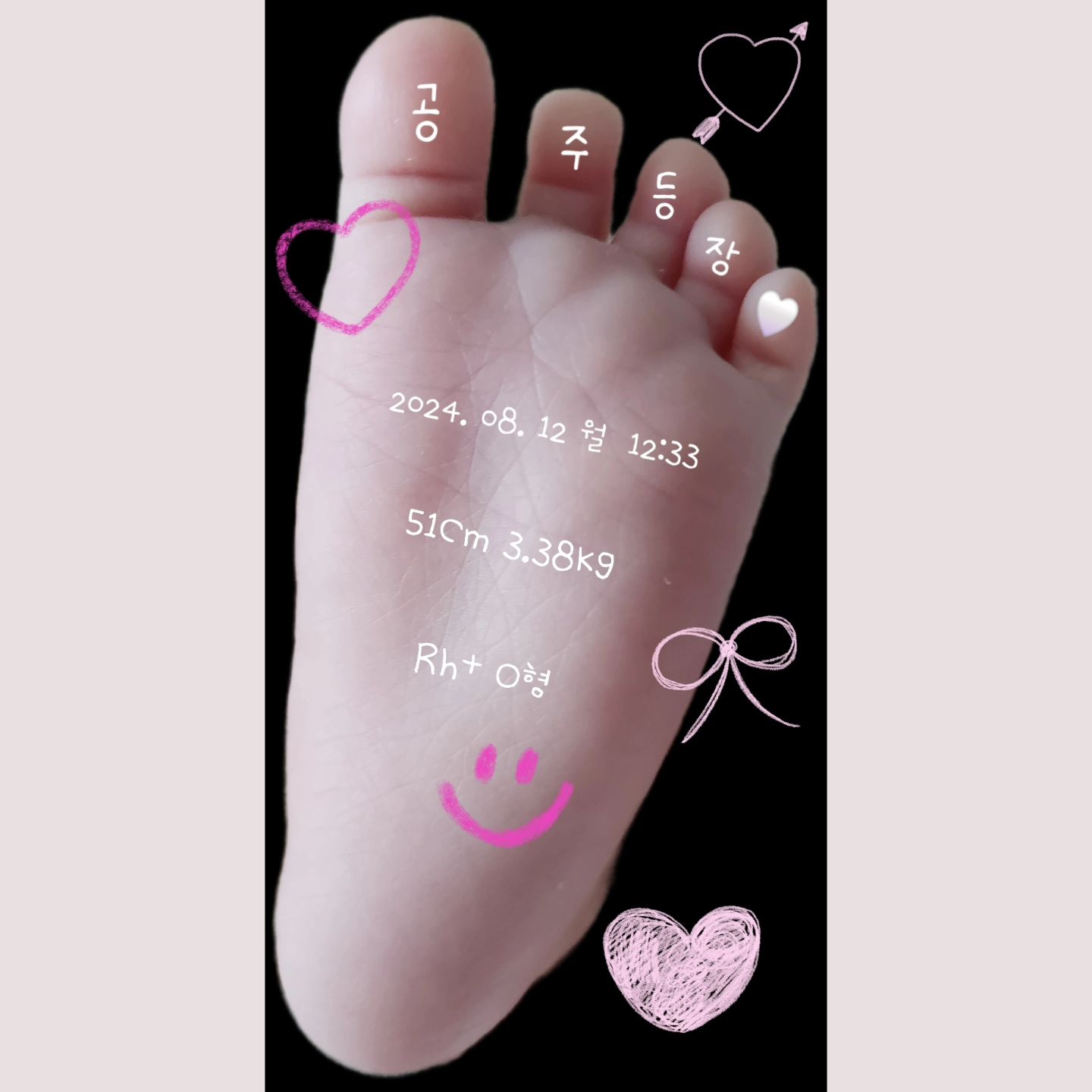 우리 애기 
신생아 졸업 🎓 
알랍u 

큰다고 고생했어 아가.. 🩶

#10개월동안불렀던 #열무