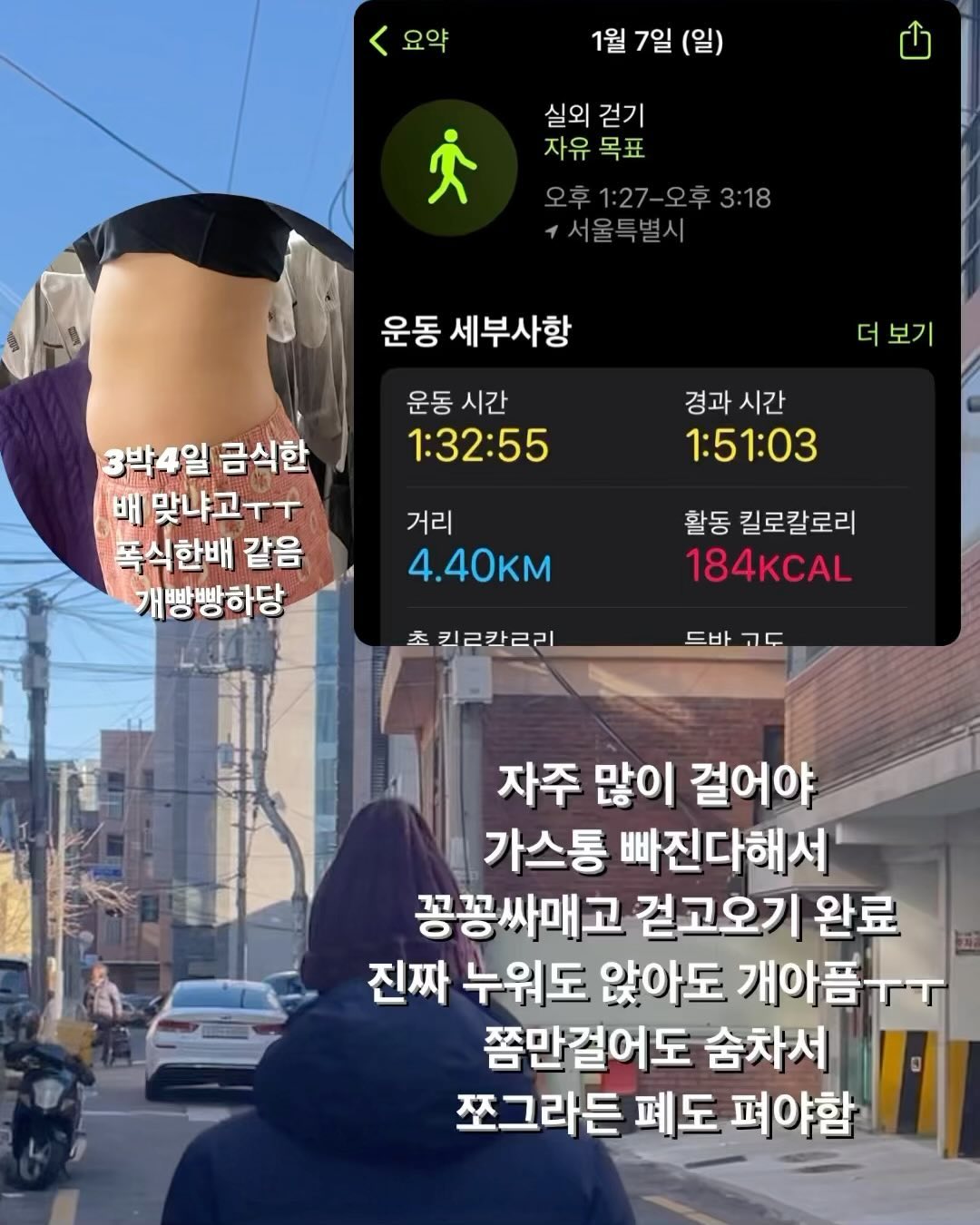 🫶🏻

진짜 너무 많은 사람들이 걱정해주고 신경써주셨다요🫶🏻
수술은 잘됐궁, 아직 조직검사 결과는 안나왔지만
수술은 깨끗하게 잘됐다고 해요!

수술할때 배에 가스를 넣어 부풀려놔서
수술 후 10일정도 배가 불편하다는데,
병원에서는 진통제 맞느냐 몰랐는데 집오니까
오장육부가 뒤틀리고 불편한게 상당해요
많이 걸을 수록 좋아진다해서 아프고 숨차는데
하루에 합 두시간~세시간 걷고있어요
배가 찢어질것 같다가도 계속 걷다보면 괜춘해지는 기뷴

퇴원하는날 집와서 배보고 기절할뻔~
3박4일 거의 먹은게 없이 수액만 맞았는데
배가 2박3일 폭식여행 한것처럼 배가 남산만함ㅋㅋ
열심히 걸어서 빨리 가스 다 빼버려야지🥹

앉고 일어서고 눕고 일어나고 웃고 재채기 구부리기
다힘든데, 그래도 빨리 알아서 수술하길 잘했다~!!
엄마가 해준 반찬에 #헬뷰닭가슴살  로 단백질채우고
#레드다이어트레몬맛  마시면서 붓기도 빼고
잘먹고 잘자고 잘걷고해서 빨리 회복해야지🫶🏻

오늘 낮에는 엄마랑 동네장보기 산책하기
저녁에 짝꿍이랑 시장구경하면서 호떡먹기
이렇게 주말도 완료❤️

#일상 #수술후기 #만보걷기 #산책 #회복 #운동하는여자 #운동하는남자 #건강 #건강식 #헬뷰 #헬스앤뷰티 #디톡스 #식단 #건강식사 #회복
