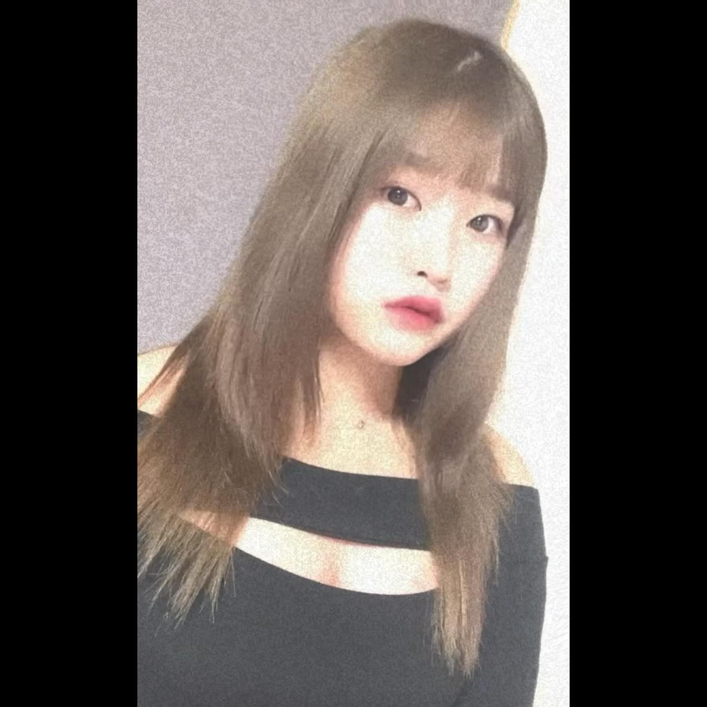 이나이먹고 쌍수하면 붓기 안빠질까욤