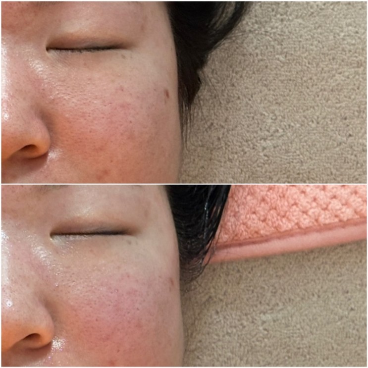신도림 피부관리 웰레스테틱 신도림점 맞춤형 에스테틱 후기