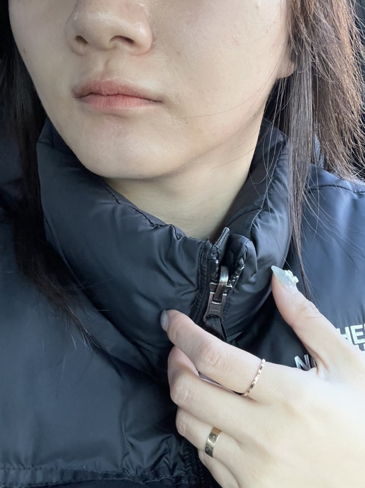 강릉역피부과추천, 텐써마 후기 리프팅 관리해요~
