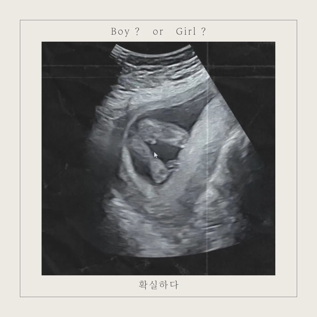 ꕀ 팔봉이의 성별은? #17w0d
　
　
　
사진만봐도 알수있지 #아둘맘 당첨 ᵎᵎᵎ
오늘 병원가는날이라고 아직모른다고 계속 주변에
그랫는데 진짜로 궁금한지 다들전화가🤣
　
그..뤠 고추🌶.....너무확실하다구..
아직 마음에준비가..안됏는데 미안해 팔봉아
형아가 상심이 아주 크단다 자기는 죽어도 여자동생이여야
한다고 그렇게 말하고다녔는데 
엄마가 잘달래볼께..
　
🧒🏻 : 나는여자동생이면 이뻐해주고 잘놀아주고,
 남자동생이면  괴롭힐꺼야 ~
　
태어나서잠깐 여자인척할까? 𐌅𐨛𐌅𐨛𐌅𐨛𐌅𐨛𐌅
　
　
#잘키워보자 #2024년생 #17주 #17주차임산부
#괜찮아 #아둘맘👨‍👩‍👦‍👦 #형제맘 #청룡띠맘