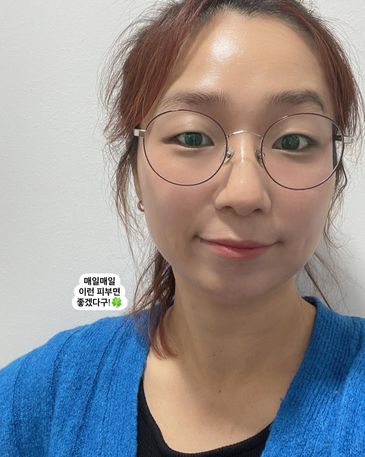 #체험단

최근 피부 트러블이 너무 속을 썩였는데 피부 트러블을 잠재울 좋은 제품 없을까  찾던 중 만나게 된 #피토릴리풀시카젤 !! 너무너무 반가운 시카제품인데요.

😊피토 릴리풀 시카 젤 클렌저로 말할 것 같으면,
🍀아침부터 저녁까지 순한 진정!
🍀한방성분이 함유되어 염증과 열을 잠재워주는 한방 시카!
🍀병풀원물로 롤링시 각질과 노폐물까지 제거되는 촉촉한 젤 클렌저
🍀아침에도 바글바글한 세균들, 모닝세안으로 하루종일 예민 피부 예방!
🍀피부와 가장 가까운 미산성으로 건강한 피부케어
👍🏻저자극 테스트는 당연히 완료!

개인적인 생각으로는 화장품같은건 타고난 피부도 있고 관리를 잘 하는 사람들도 있으니 후기만 보고는 믿기 힘든게 사실인데, 내가 직접 발라보고 비포&애프터를 남겨보니 눈에 띄게 개선되는게 보여서 너무나 만족한 제품이라 여드름피부, 예민한 피부를 가진 분들에게 특히 추천하고 싶어요🥹 게다가 눈시림도 없다구요🥹!!

제품의 세정력도, 개운하고 싱그러운 향기도, 너무 묽지도 단단하지도 않아서 롤링하기 좋은 제형도 모두 맘에 들었고요. 병풍원물 입자가 커보여서 각질제거제의 큰 알갱이 느낌이면 어쩌나 했는데 롤링할때 걸리적거리거나 부담이 없어서 불편함 없이 사용했고, 일주일정도를 아침저녁으로 사용했는데 이정도의 만족도라면 앞으로도 쭉 사용 할 수 있을 것 같습니다😉 

thankyoufarmer_kr 
#땡큐파머 #THANKYOUFARMER #피토릴리풀시카젤클렌저 #시카클렌저 #건성클렌저 #지성클렌저 #수부지클렌저
#여드름클렌저 #클렌징폼추천 #클렌징폼 #젤클렌저 #미산성클렌저