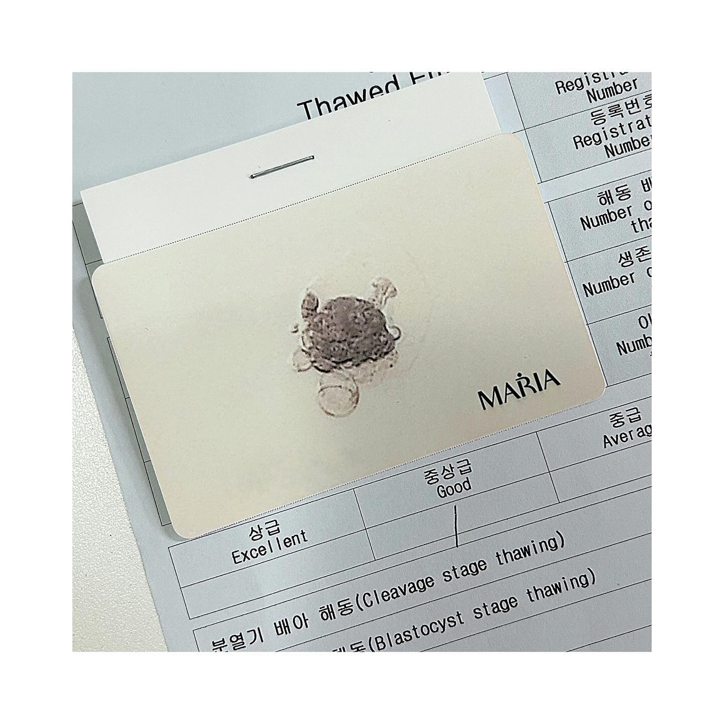 :)
__
[ 시험관 동결 2차 배아 이식 👼🏻✨ ] 

1 ) 이번엔 ' 중상 ' .. 맨날 상 ' 만 보다가 중상 을 보니 아쉽기도 하구 ..
 모양도 전혀 예상치 못한 모양이라 .. 이게 머선일이야 ㅠㅠ .. 

2 ) 콩주사는 진짜 너무 아프다 🤮 혈관통 심한사람에겐 정말 곤욕 🤢 

3 ) 이식 끝난 후 매콤한게 땡겨서 오랜만에 얼큰해물짬뽕 냠냠 🍜 

4 ) 이번엔 야무지게 사탕챙겨가기! 삼신할모니 아가천사 주세요오!!! 👼🏻 

5 ) 저녁으로 단백질 충전 ' 💪🏻 소고기 와구와구와구 🥩🥩 

6 ) 팔이 남아나질않아요 ... 누가보면 맞고 다니는 줄 알겠써요 .. ㅠㅠ 

7 ) 눙물의 크녹산 💧💧 진짜 맞자마자 눈물 줄줄 .. 피 줄줄 .. 😭 

8 ) 옴마맘도 모르고 유촌에서 씐나게 노는 공쥬 , 커여워서 봐줌 🐾❤ 

•┈┈┈•┈┈┈•┈┈┈•┈┈┈•┈┈┈•┈┈┈•┈┈┈•┈┈┈•┈

어제 이식 잘 끝내구 왔숩니다! 지금까지 배아등급이 상 ' 이었어서
아무 걱정없이 갔는데 , '중상 ' 이라는 말 들으니 갑자기 마음이 쿵 ..🫥 

그래도 선생님께서 안좋은건 아니니 걱정하지말라구 하시는데도 , 
아무말도 안들리더라구요 .. ㅋㅋㅋ 머릿속으로 계속 ' 뭐지 .. 뭘까 .. 뭐야 ..' 

해동하는 과정에서 혼자하는 부화가 늦어서 레이저를 이용해 
임의로 부화를 도왔다 하더라구요 😢 이런일도 있는거겠져 .. ?? 

혈관이 좁고 약해서 항상 링거가 쉽지 않아 간호사님들께 미안한 마음이ㅠ
그 대신 혈관 통도 심하고 멍도 잘 들어서 팔이 남아나질 않는답니다ㅠ 

크녹산주사 와 .. 진짜 너무 아파요 너무!!!!! 죽겠다구요!!!! 
맞자마자 눈물이 저절로 .. 지혈도 안돼서 피도 줄줄ㅠ 서러워요 정말 😭 

걱정없이 간 만큼 조금은 아쉽고 , 생각이 많은 이식이었지만 
그래도 긍정적인 생각만 하기!!! 올해가기전에 얼른 와주라 제발!!!! ❤🤎