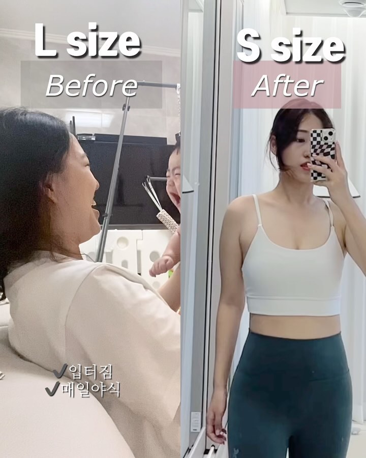 먹는걸로시작해 자기직전까지 먹고먹던 지난날의 스토리..😱😱
지배당한 #식욕의길 #프로야식러

얼굴살 진.짜 없는편인데,,, 턱아랫살 말린어깨 팔뚝..그리고 뱃살🥹
몇년전 스토리보는데 진짜 먹는거 참 좋아했다ㅠㅠ
⠀ 
아니, 안 먹거나 덜 먹는날은 불안하기도
밤마다 배달 야식...먹을거 떨어지면 바로 편의점행🔥🔥
스트레스만 받으면 또 먹는걸로 풀던 식욕의 식욕‼️
사실 먹는거에서 대부분 무너지잖아요.
⠀ 
✔️배가 찼음에도 무언가 더 먹게되는 가능성
✔️안먹어도 되는상황 단짠 탄수 무한흡입...
✔️식욕자가컨트롤 자체가 어렵다는 증거,
= 즉 다이어트의 악순환. 이갈고 만든 #올라잇레드 식욕감소O.K❗️
⠀ 
❤️레드의 주원료❤️
✔️그린커피빈주정추출물 + 녹차추출물+’이트레스‘시너지⬆️
탁월한 ’식욕억제 + 체지방감량‘ 한마디로⬇️
⠀ 
‼️식욕억제 + 체지방감소 한번에 케어‼️
⠀ 
다음주 설이죠, 지금 전국택배 빡빡해요 ! 명절전 받으려면
🚛🚛오늘밤,내일 주문시 가장빠르게 택배받으세요 !
그다음 주문시 연휴마친뒤로 발주 넘어가요
⠀ 
#올라잇레드 임상실험결과🔻
➿체지방감소
➿허리둘레감소
➿피하지방면적 / 복부지방면적감소
➿총 지방면적 / BMI지수감소
⠀ 
⚠️식전1포, 매끼니 가능.하루일과 어느때도 가능

올라잇레드는 모든원료 안전성 입증된 성분
✅일반적으로
식욕억제 제품군에 공통되는
👉🏻잠못잠 두통 두드러기 심혈관
소화관련 등 부작용 걱정 ❌부작용걱정없이 섭취⭕️
⠀ 
현재 기본2box이상, 대부분 4+1박스더
🛎️대용량주문 많아요 adue.se 프로필에서
내일오전 9시반주문 당일출고해요
⠀ 
🎁아듀증정 구매이벤트👉🏻”아듀“주문시자동참여⬇️
디올립밤•올라잇단품•의료압박밴드•스벅쿠폰