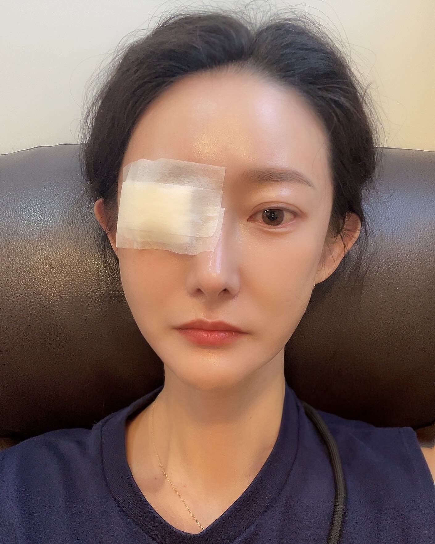 해적이 되자!
이얍! 이얍! 
😓😓😓😓😓

나는 슬프다…
왜냐하면 슬프기 때문이다…
😭😭😭😭😭

뭐래~~~!

내인생 첫 다래끼 시술….
하필이면 명절 연휴 전에 아파서 제 시기를 놓쳐버렸다..항생제를 먹는데도 안 없어져서 안과 왔더니 바로 째는 수밖에 없다며..아프다며…

마음의 준비따위 개나 줘버려~

막 그냥 영혼없이 째면 아프긴 하다 하더니 아래 쳐다보래. 
막 안보이는데 주섬주섬 하더니 눈꺼풀 뒤집고 찌릿! 
째..쨌어….
막 눌러~ 쭉쭉~ 한번도 아니고 계속눌러~~
아파서 눈물이 또르르도 아니고 드르르륵 흐를때쯤 
끝났대. 잘 참는대. 
“근데요, 이거 다 없애면 쌍수라인 변할 수도 있어서 손에 만져지기는 할거에요.”

농이 캡슐에 쌓여있는데 굳어서 다 제거라려면 캡슐을 째야된댄다. 근데 그러면 피부 밖으로 튀어나올 수도 있고 쌍수 라인에 변화가 생길 수도 있어서 그냥 남은채로 있는데 낫대. 
난 그냥 아무말도 안들리고 남은 눈도 제대로 못 뜨겠는데 약도 빌라야 하고 약도 넣어야 하고 참내…

나 여태 면역 괜찮게 잘 살았는데 왜 때문에 갑자기 올해 이렇게 이픈거지…? 다래끼도 안나서 이런 아픔 겪어보지도 못했는데…ㅠ ㅠ 

집에가자…
안과 나와서 하늘보고 한숨만 쉬다가 글썽이며 끄덕였네…

신호등 네번 바꼈어…

#일상 #소통 #눈다래끼 #병원투어 #아프지말자 #나왜이래 #daily #eyeclinic #astyintheeye #imcrying #followforfollowback #dontbesick