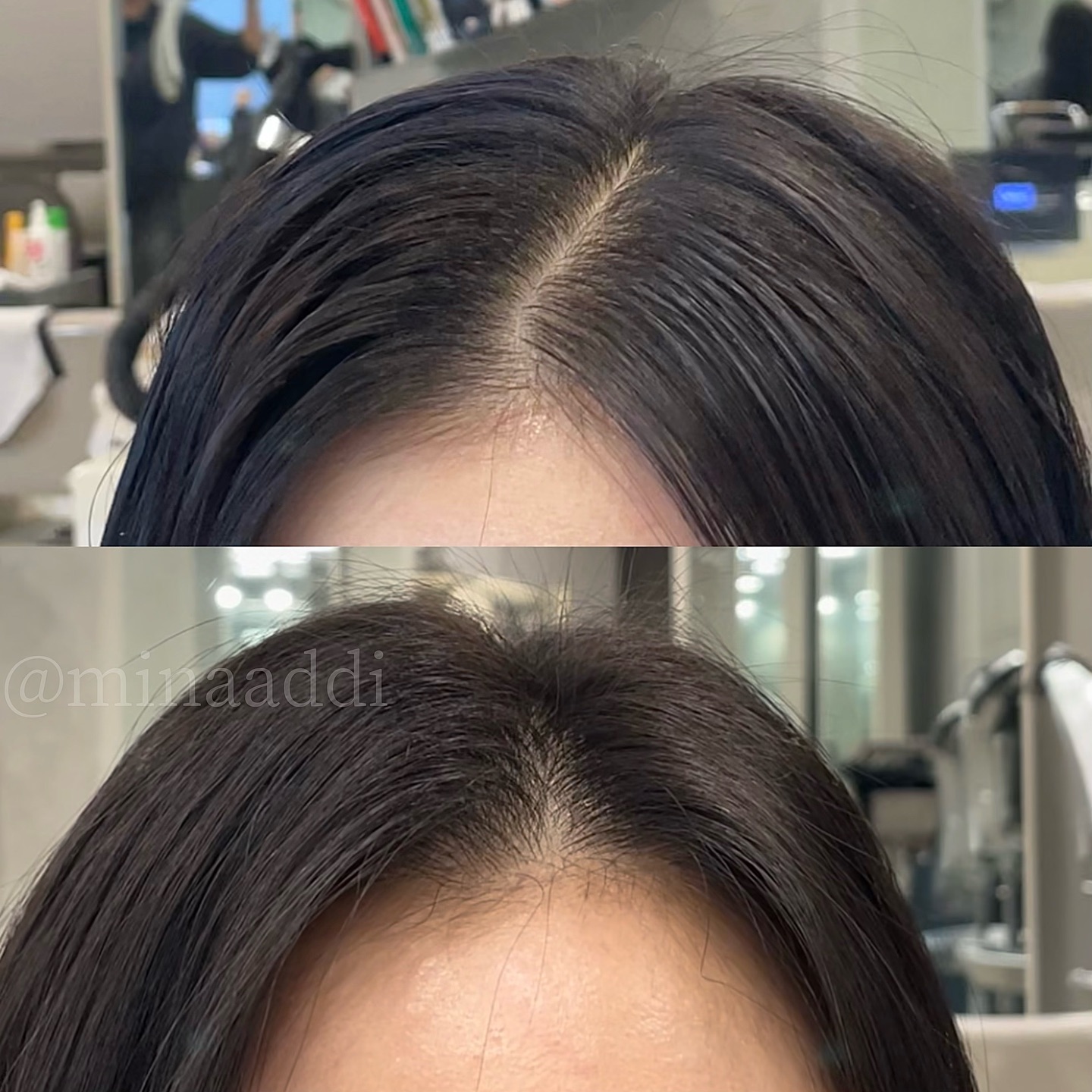 두상성형 #뿌리펌 #비포애프터
.
.
정수리가 높고 앞볼륨이 낮은 두상을 
콘헤드 두상이라고 부릅니다
이런 두상은 가르마 시작 지점이 제일 중요해서 
이 부분을 중점적으로 신경을 썼어요!

인위적인 볼륨보다는 자연스러움을 추구하며
본인의 얼굴형과 두상에 맞는 볼륨을 찾아주는 
1:1 #퍼스널디자인 으로 진행됩니다😊

✔️시술시간 1시간 30분
✔️시술주기 6-8주 권장
✔️시술금액 dm 문의(수험생&유학생이벤트중입니다🤍)

#어려지고싶다면_민아쌤 minaaddi
앳나운 공식 계정 atnown 

#앳나운231209 #뿌리볼륨펌 #볼륨펌 #연말파티룩 #연말메이크업 #뿌리볼륨 #연말이벤트 #수험생이벤트