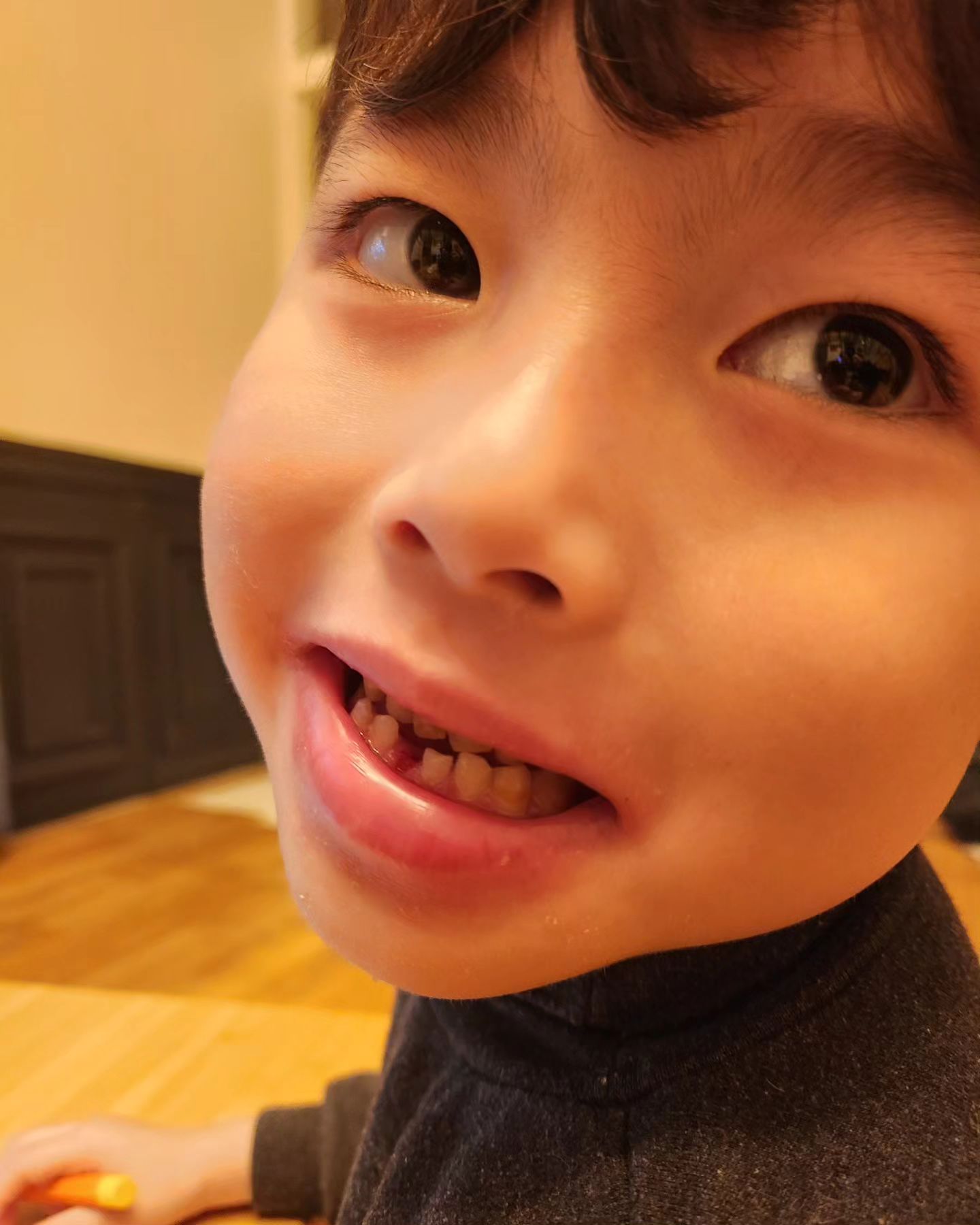우리아들 첫 젖니 발치~~!!!
흔들리는거 빼려고 몇번을 시도해도 
쫄보 녀석 도망치기 바빴는데 사과드시다 빠짐!!ㅎㅎ
이빠진 모습도 귀여워 😍💕
울 라온이 이렇게 또 성장하는구나~~~~~~

#육아스타그램#아들스타그램#첫젖니#작고#소중해#건강한#영구치야예쁘게나오렴#육아일상#소소한행복