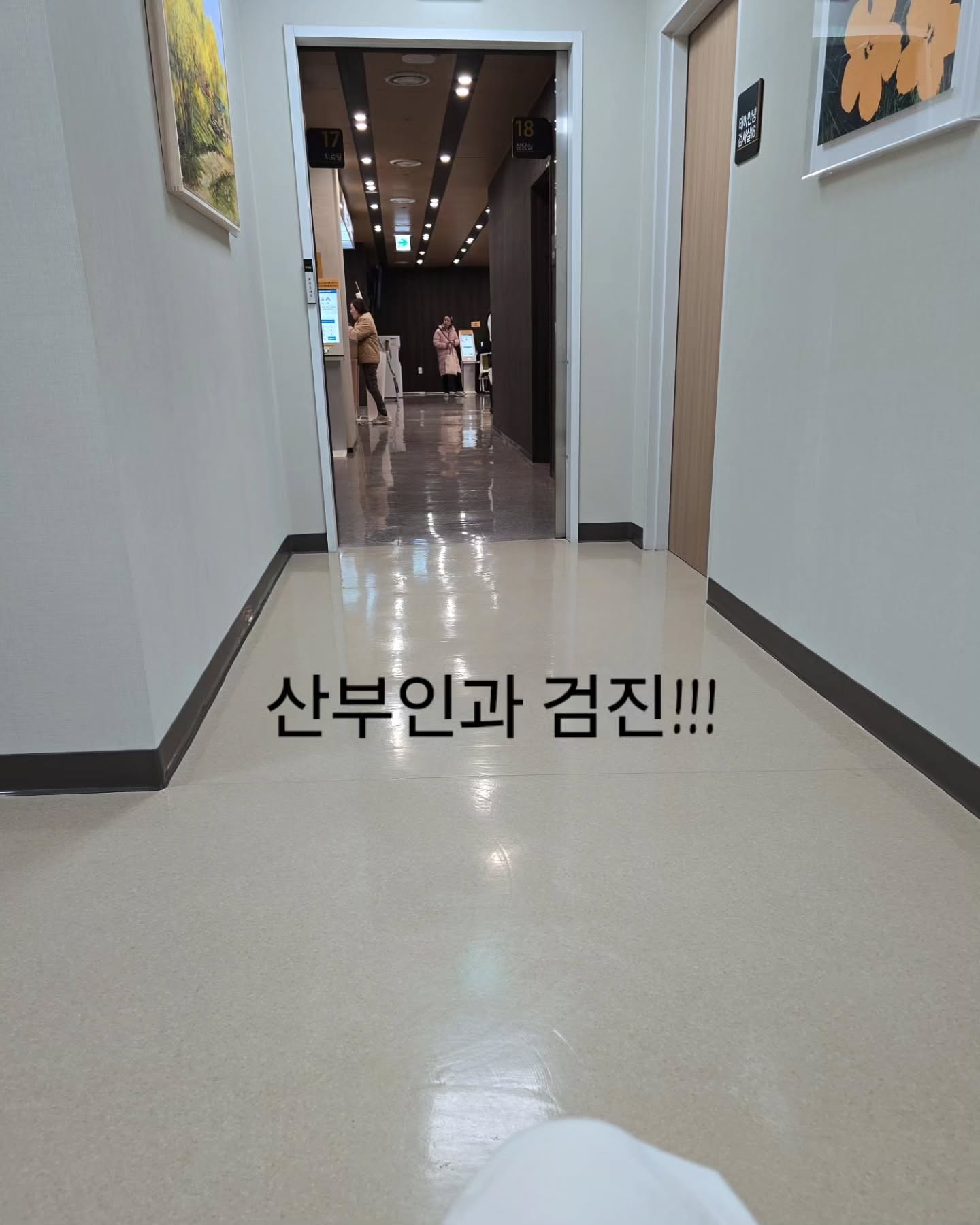 자꾸 까먹어여; 
언제부턴가...병원 진료시,
이렇습니다. 눼에?!!!🫢놀랬다가..
검사하고 결과 괜찮으면 .. 
됐어 문제될거 없네! 이러고 
기억에서 자우나봐여 ㅋㅋㅋ

올해 산부인과 검진하고 
엄청 힘들어 했던것 같은데 말이죠 ㅋㅋㅋㅋ

쭈욱 추적관찰중이라 기록해 두려구요;
(난소 혹 3,8cm / 자궁근종들 크기 변화없음)
난소 혹은 4cm가 넘으면 수술해야 한대욥
4cm 이상시_꼬이면 아프고, 풀리면 안아프고,
그러다 전조증상 없이 터지면 응급수술 이래요.

응급수술 하게 될까봐 미리 수술하는분들도 있긴한데,
수술을 하는것보단 안하는게 낫고,
수술하긴 애매한 크기고 긴시간 크기변함이 없으니
일단 두고보자했어요.

#용인세브란스 #용인산부인과 #어경진교수님