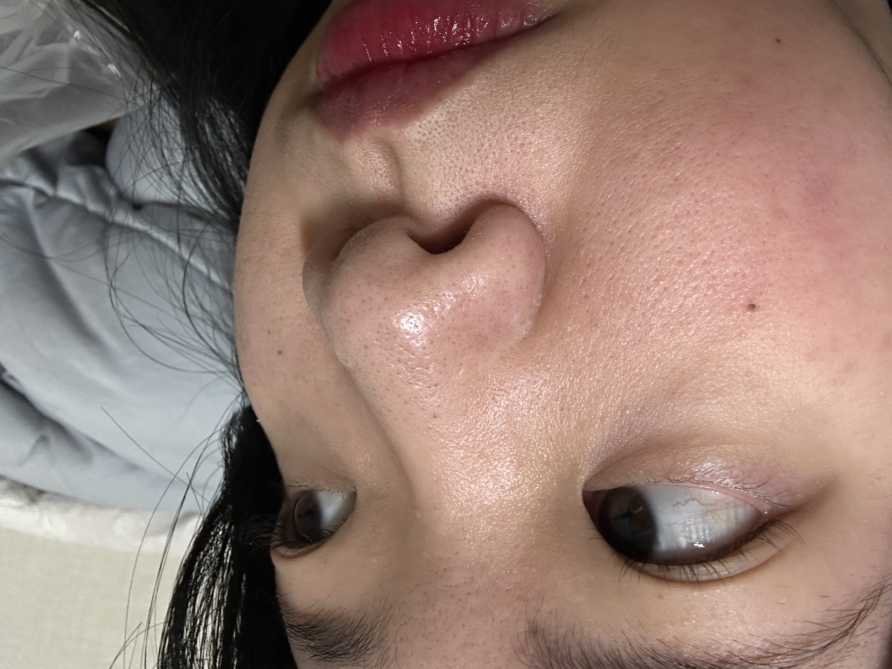 [임피엘] 시카 비건 아크네 클리어 앰플