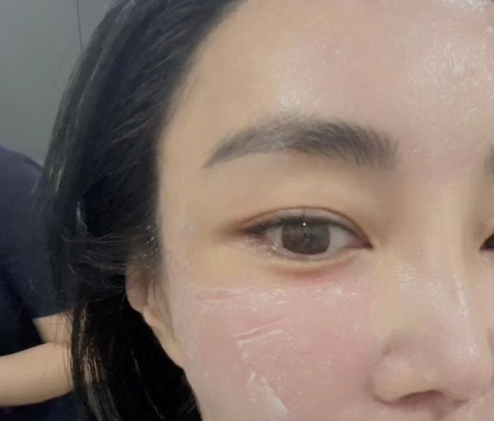 #협찬 #미안하다그램 
갑자기 하게 된 흉터수술로 다 못보여준다. #안구보호
#베네투스
불타는 홍당무#그게나야
붉은기만 없으면 17호19호#그게나야둠빠둠빠두비두바 
.
.
.
.
.
.
선크림 안바르면 안된다는거, 다들 머리로는 알고 있는데
아직은 괜찮은 피부에 방심하고 있진 않으신지.
피부 하나는 좋단말 듣고 남들 가방살때 기초에 올인 했다가
방심한 사이에 기미색소홍조 흑자까지 올라와서 
선크림의 중요성 각성함
.
.
무기자차 vs 유기자차
자외선을 튕겨내는 방식이 무기자차
자외선을 흡수 후 소멸 시키는 방식이 유기자차
어떤게 내 피부에 맞는지 정확히 알 수 없어서 탄생한
유기자차+무기자차 두가지 장점을 섞은 자외선 차단 혼합자차
.
.
.
.
선크림 생태계를 뒤흔든 #베네투스투인원멀티썬썬크림 
붉은기에 그린 올렸더니 붉은기 완화되고 거기어 몽글몽글
핑크 올렸더니 화사해 져! 선크림을 베이스 대신에 쓰면 돼.
💩 손도 메이크업 가능 위에 쿠션으로 마무리 톡톡
.
.
.
흉터치료 끝나구 제대로 보여주겠음 ✌️ 
#베네투스투인원멀티썬#유기자차#무기자차선크림#자외선차단#혼합자차#논나노입자#어렵다#써보면알아#코덕#잘견디고있음