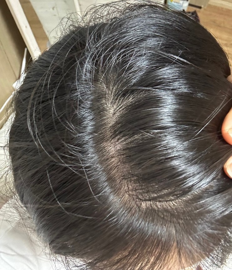 뿌리볼륨 살아나는 탈모샴푸추천 메디큐브 소이시딜샴푸