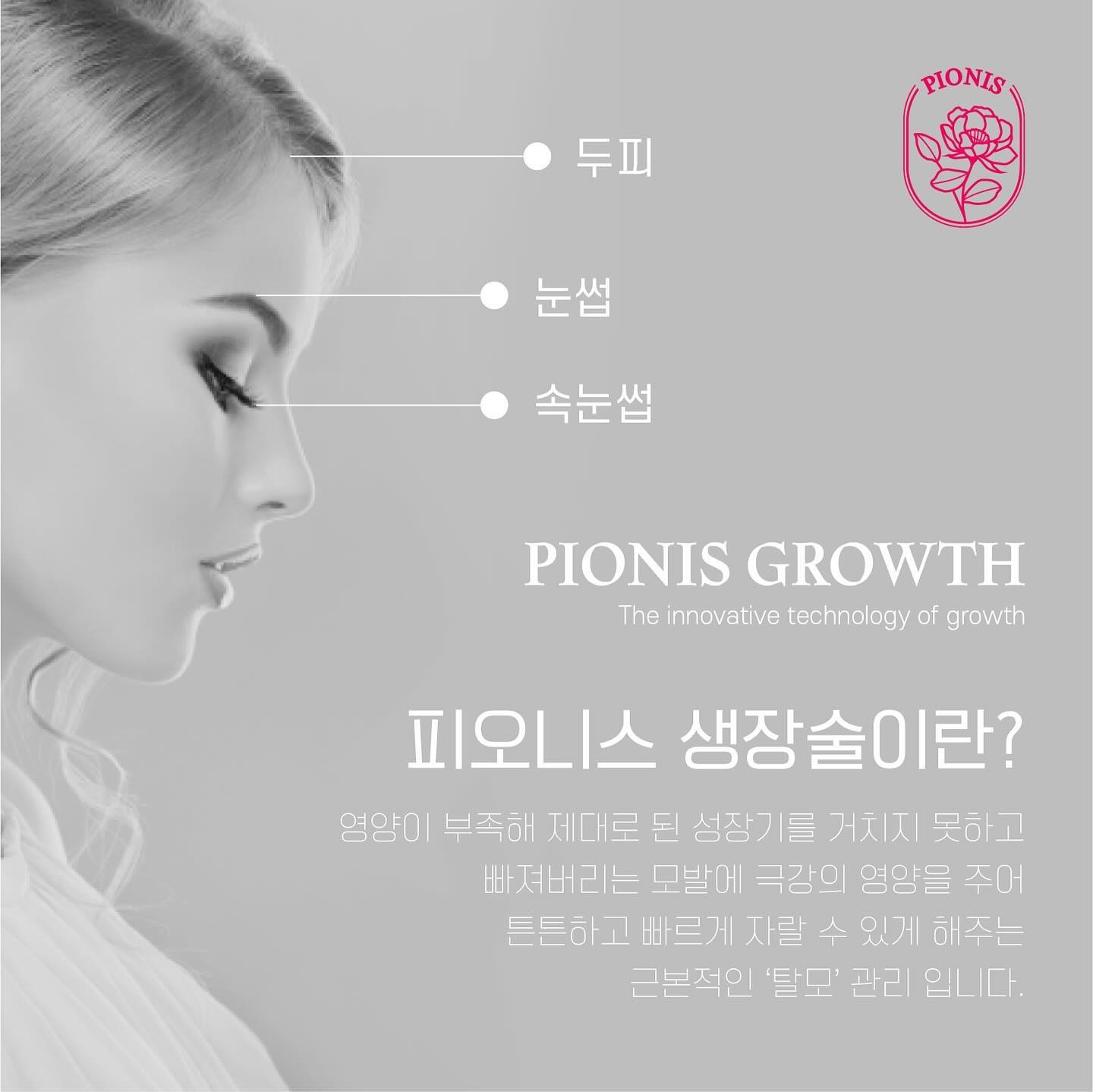 그동안 샵 방문하셨던 고객님들은 이미 아시겠지만,,!!

여러 생장 브랜드 중 페르레이가 선택한 #피오니스
피오니스생장술은 당연 최고라고 할 수 있을 거 같아요 

왜냐구요? 

🙋🏻‍♀️진짜 머리가 나나요?

- 저 또한 의문을 가지고 시작한 건 맞아요
사실 하루 아침에 머리가 듬뿍 난다고 하면 탈모를 가진 분들은 아무도 없겠죠🙅🏻‍♀️

본사의 수많은 임상과 피오니스를 하시는 분들의 임상 결과는 이미 많이 봐와서 알고 있어요

하지만,,!!!

전 제가 직!접! 하고 보고 느껴봐야 하는 사람,,😆

이제는 정말 자신 있게 소개해드리려구요

진쨔!! 머리카락이 없는 대머리 반질하신분도 머리카락이 나요 

주성분인 완두콩펩타이드는 모발생성세포인 모유두세포를 자극하여 탈모관련 신호 전달 물질의 하나인 TGF-β1 활성을 감소시키는 역할을 합니다.

그로인해, 
➡️ 탈모현상을 억제하거나 
➡️ 탈모원인을 완화시켜주는 역할을 하기 때문에
가장 과학적인 접근 방식으로 탈모증상에 탁월한 #피오니스생장술

🤍 상담 원하시면 Dm 주세요
페르레이에서 피오니스관리 받으세요🫶🏻