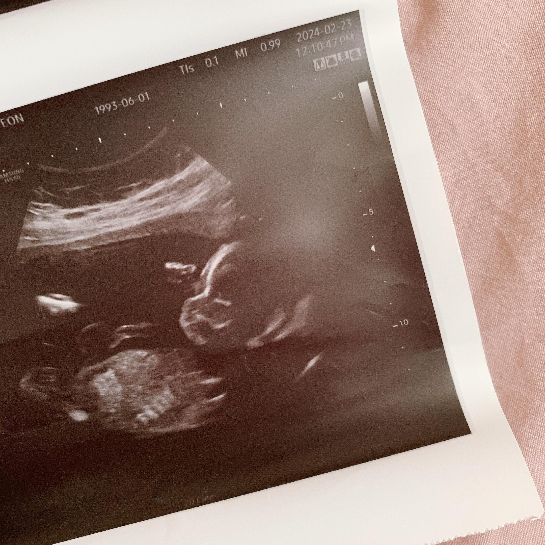 너무 귀여운 우리땡글이👶🏻
이번주에 만나러 간다 🖤