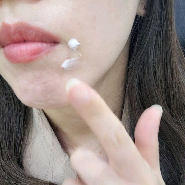 #협찬
#일루미엘 에이씨 솔루션 크림 40ml
약산성 피지 #여드름크림

요즘 턱에 피지가 쌓이면서 트러블이 계속 올라왔어~
뭘 발라야 할지 고민했었는데,
#illumiel #여드름화장품 검색하니까 나오더라구!

근데 피지와 여드름에 자극적이게 케어를 하면 더 난리나고
보습도 중요해서 #보습크림 기능도 있어야 하고,
#시카크림 기능도 있었으면 했던거야

근데 이 크림을 바르니까
피부가 즉각 시원한 느낌이 나면서
가벼운 질감도 아닌데 꾸덕하면서 피부에 장벽을 만들어 주는 느낌을 받았어
그렇다고 끈적하지도 않고 겉은 뽀송하게 마무리 되는데
피부속은 채워진 느낌인데
피부는 정말 시원한 느낌이 나

이거 정말 발라봐야 느끼는데 ㅎㅎㅎ
글로 설명 할려니까 힘드네 ~!

여기서 구매 가능해
https://smartstore.naver.com/illumiel/products/8932921139