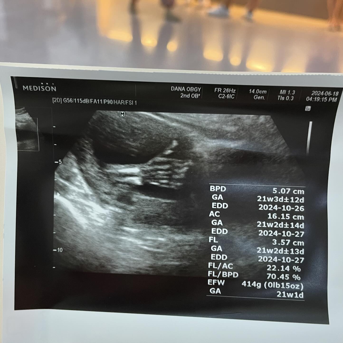 수박이 is good 👶🏻👍🏻
한달뒤에 만나용 ! 

#임신21주 #정밀초음파 #굿