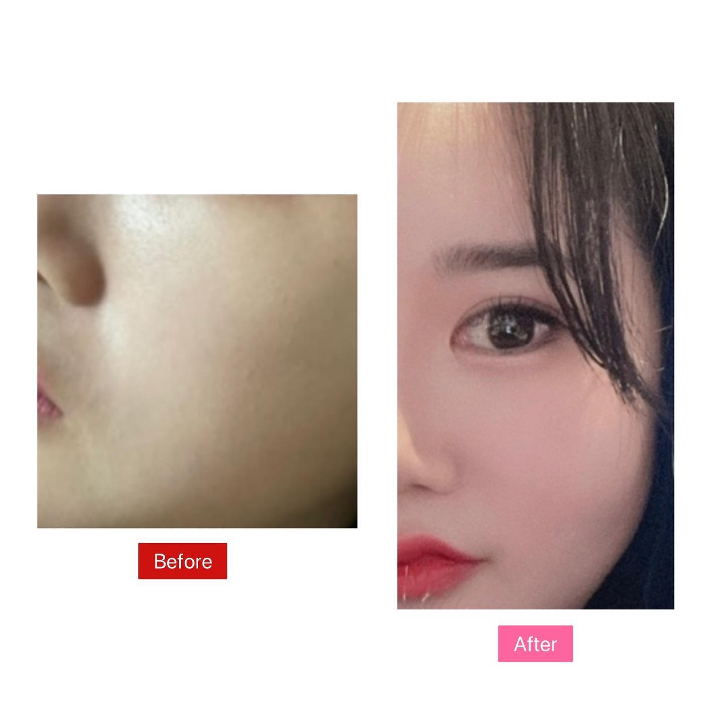 피부가 핑크빛으로 바뀌는거 뭐쥬 ? 

해미 비비 브라이트닝밤 비비크림을 
제공받아 안그래도 파운데이션이 떨어져 한줄기 빛같은 비비크림 ㅠ 근데 가격도 저렴이인데 효능 뭐죠? 😁

<효능>
-오르자드비비 리뉴얼상품
-필링 또는 피부과 시술 후 자극받은 예민피부도 진정가능한 허브성분이 들어가있는 비비 
-캐모마일 허브에서 추출한 성분으로 촉촉한 보습을 원하는 피부에 연출
-캐모마일이 함유되어 살균 성분이 피부 진정에 도움을줌
-쇠비름 추출물이 울긋불긋한 피부를 맑고 깨끗하게 가꿔주는 추출물이 피부연출을 도움
-알란토인 성분이 건조하고 예민해 거칠어진 피부에 수분감을 줘 편안한 피부로 가꿔줌
-천연보습성분에 항상화효과,피지조절까지 해주는 만능 호호바오일이 속부터 채운 보습으로 꿀광피부를 연출시켜줌

#해미비비 #해미브라이트닝밤#노랑비비 #물광비비 #혜리비비  #재생비비 #승무원비비 #찰떡비비 #착붙비비 #헤미비비#헤미브라이트닝밤