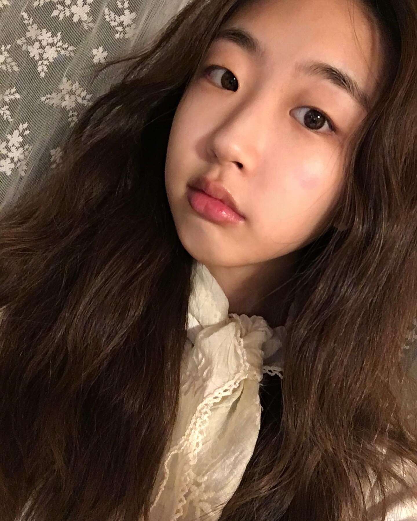 볼이간지러워서긁었는데저렇게빨개졌네요너무거슬려-!