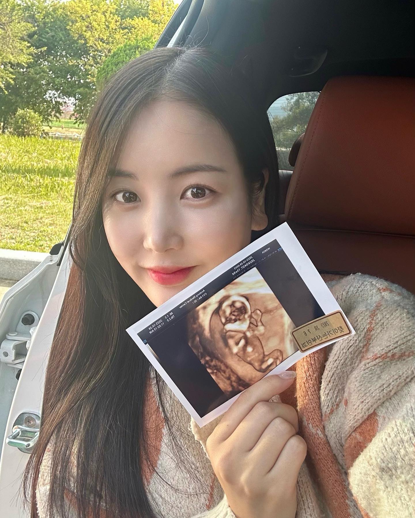 새싹이 잘 보고 왔어요 🌱💚

아니 우리 슨생님……
다리 사이 한참을 봐주셨는데
확정을 안 해주시네요…?
다음 진료 때 정확하게 보자 하시는데
내일 그냥 출산할 병원에 가서
다이렉트로 물어볼까 싶어요 🫠
 ⠀
초음파 영상 무한 재생 중,,,,
 ⠀
 ⠀