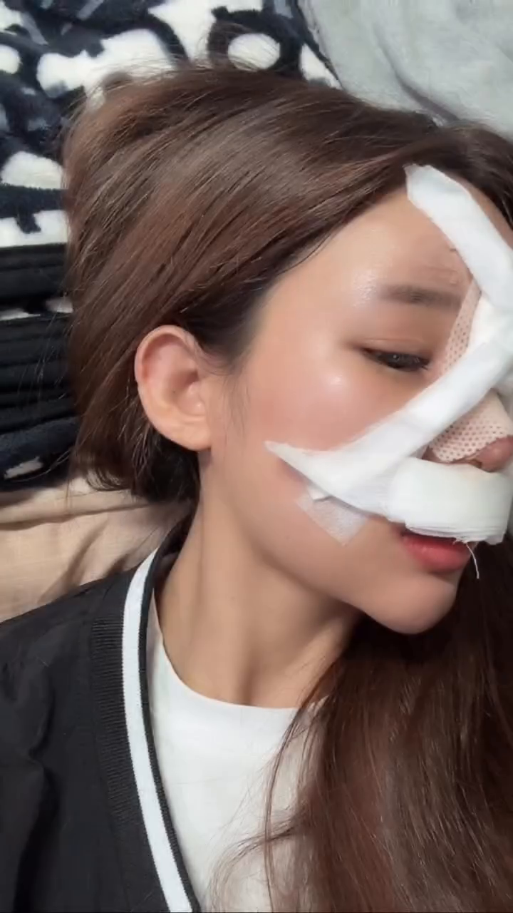 기능코+미용코 주3회 부산행 힘들어따,,
수술당일에도 지각한사람^^! 원장님 지송해유
서울왔다갔다는 꿈도못꿔ㅠ 존경합니다 서울가는님덜
나 수술하고 개아프다고 걍 하지마라고 했었는데
한 2-3일 아파보능것도 나쁘지 않다고 생각해요^^ㅋㅋㅋㅋㅋㅋㅋㅋㅋㅋㅋㅋㅎㅎㅎㅎㅎㅎㅎㅎㅎㅎㅎㅎㅎㅎ
.
#코수술 
#기능코성형 
#코수술후기 
#코성형후기