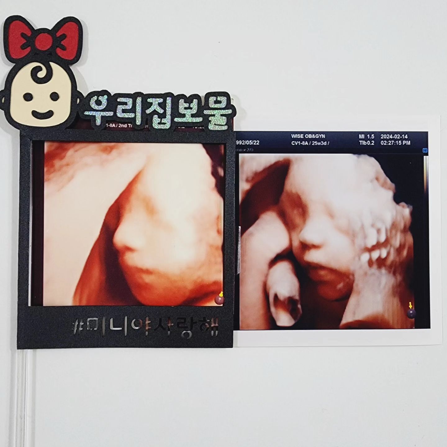 🤍왼쪽 서아 오른쪽 로아🤍

#입체초음파 보면 둘이 비슷한 느낌🥰
 
 

서아야 로아야
몸도 마음도 그저 건강하게만 자라렴🩷🩵!
 
 
 ෆ24.02ෆ
#미니미니이야기 #미니미니이야기_46개월
#서로서로이야기 #서로남매이야기
#포도포도이야기_임신 #포도포도이야기
#예비둘째맘 #예비남매맘 #남매맘 #남매그램
#예비청룡띠맘 #청룡띠아들 #흰쥐띠딸