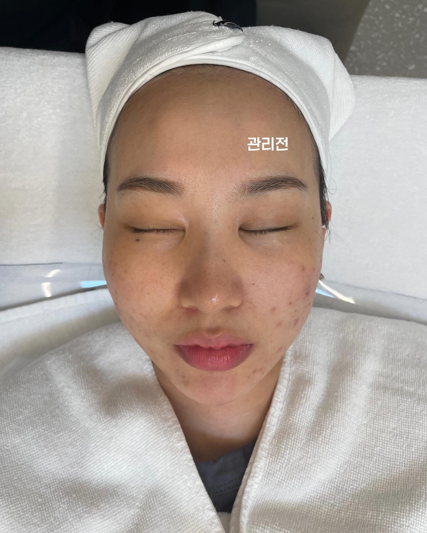 #협찬

날씨가 더워지면서  얼굴에 화이트헤드와 블랙헤드와의 전쟁이 시작되는데요,
그러다보니 화장도 아나먹고 둥둥뜨는 느낌적인 느낌.. 각질제거를 해도 항상 다시 제자리로 돌아오는것같아서

각질제거만의 답이 아닌거같아 검색의 검색을 하다가 #스킨플래닝 이라는걸 받기로 결심했다!

* 스킨플래닝이란?
단순 잔털 솜톨 제거하는 시술이 아닌, 전용 블레이드를 사용해서 피부표면에 존재하는 노폐물, 죽은각질, 잔털/솜털 , 미세먼지, 산화된 피지를 제거

장곡동 #은은한결 
 오픈한지 얼마되지않아 첫방문고객 / 재방문고객 할인도 가능하니 네이버예약 통해서 예약하시고 방문하시는걸 추천 !

매장은 정말 깔끔 / 그리고 은은한 좋은향기 
원장님이 위생과 청결을 엄청 신경쓰시는걸 매장을 보면 딱 알수있었다.

저는 피부가 정말 예민하고 붉은기도 심해서 시술 후 자극이 더 되지는 않을까? 라는 고민도 있었는데
은은한결에서는 콜라겐앰플 및 마무리 진정케어까지 완벽하게 해주셨어요.

시술 후 제거된 솜털과 각질들을 보고 얼마나 놀랬는지, 그리고 뭔가 개운함

받고난후 가장 신기했던건 스킨케어 흡수가 잘되고 은은한 윤광도 나서 많은시간이 필요하지 않고, 짧은시간 내에 피부결을 개선할수 있어서 좋았어요- 

저처럼 피부화장이 안먹고 둥둥뜨는 느낌이 나신다면 스킨플래닝 한번 고민해보세요!

#사흥스킨플래닝 #장현스킨플래닝 #시흥피부관리샵 #장현동피부관리