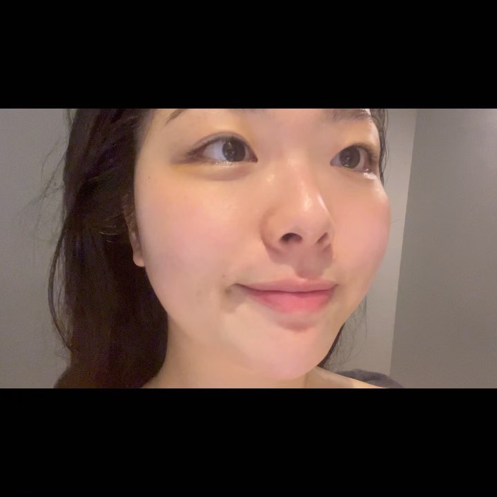 ✔️아이폰 기본카메라로 무보정한 피부예요! 광나는거 보이시나요?✨ 관리직후에 너무 만족스러워서 영상으로 남겨봤어요!

제가 지난주에 다녀왔던 피부관리 샵 너무 만족해서 재방문한 후기 가지규 왔어요!❤️

제가 이날 받은 관리는 LDM관리 였어요!

✔️LDM관리란?
고강도 초음파를 이용하여 세포재생을 유도하고 피부의 면역력을 향상시키며 콜라겐 생성을 촉진

15분동안 피부에 관리를 진행해주십니당
모델링팩 진행해주는 마무리 단계에서도 쉬지 않으시고 데콜테 관리 까지 해주셔서 너무나 만족스러웠던 관리❤️

일산 주엽쪽에서 피부관리 잘하는곳 찾으시면 #스파에비뉴 정말 강추드러요!

+ 자세한 후기는 프로필 상단 블로그 링크타고 가시면 확인하실 수 있습니당

(업체로 부터 서비스는 제공 받았지만 인스타 노출 의무 없고 너무 만족해서 제가 자발적으로 올리는 후기예요!)

- 주차 5시간무료로 주차도 편하게 가능!😊

#주엽피부관리 #주엽피부과 #일산피부관리 #일산피부 #주엽에스테틱 #일산에스테틱 #킨텍스피부관리 #킨텍스에스테틱 #주엽마사지 #일산마사지 #일산마사지샵