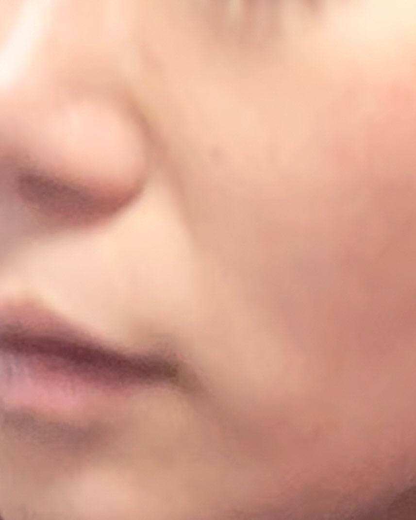 #인천실리프팅 #pcl실리프팅후기