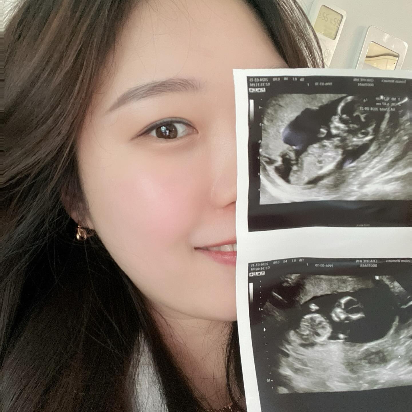 안녕 이꿀떡👶🏻🍯

1. 어제 보고 온 꿀떡이 굉장히 활발함!!🐉🐉
(성별은 아직 정확하지 않아 비밀이지롱)
2. 여린이가 생일 겸 꿀떡이 환영해준 케이크
3. 처음 만난 날 콩만한 아기집👣
4. 제일 귀엽다는 하리보 시절🥹🥹🥹✨💛
5. 점점 사람같아 지는 중〰️
6. 엄청나게 움직여서 몇번이나 담당쌤 헛웃음 짓게 한 아가🧸
🙏🏻마지막 동영상 꿀귀.. 꼭 보기 (도치맘 맞음)🙏🏻

요즘 이런 저런 핑계로 만나자는 약속 다 파토내고.. 
연락도 뜸해지고 ,, 술쟁이 술 안먹어서 다들 눈치 챘을 것 같은뎈ㅋㅋㅋ
다들 아무말 안 하고 기다려줘서 감사합니다💖💖💖

🎀
안녕하십니까 이모삼촌들!!!!
이꿀떡 인사 거하게 박겠습니다 🙌🏻🙌🏻🙌🏻 
이모 삼촌들 9월에 만나요〰️〰️❤️

#임밍아웃 #12w5d