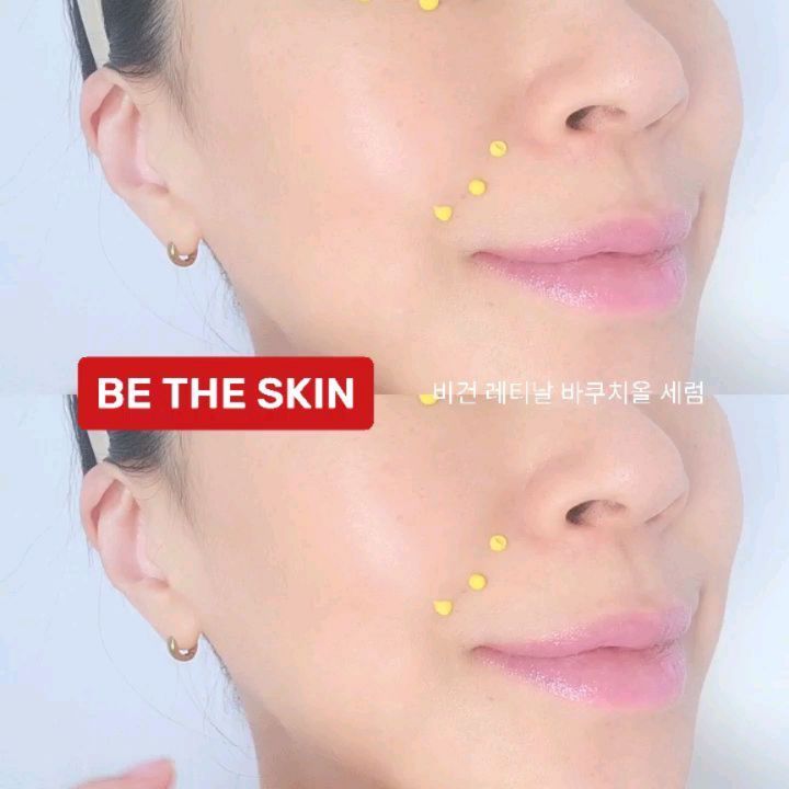 #제품제공

비더스킨 비건 레티날 바쿠치올 세럼🌛

제가요즘 밤에만 집중적으로 주름케어해주고있는
비더스킨 레티날+바쿠치올 세럼입니다
레티날과 바쿠치올, 세라마이드,펩타이드 성분을
서로 보완시킨 배합으로 자극없이 확실하게 케어해주는데요

일명 '테이프세럼'으로 테이프를 쫙 당겨펴듯이
주름을 쫙 펴준다고해서 붙은 별명이져 😉

37년차 제조와 연구소를 보유한 비더스킨은
미국에서 더유명한 🇰🇷K뷰티 브랜드죠? 
그런 비더스킨에서 작정하고 만든 레티날,바쿠치올 세럼으로
피부엔 무자극 판정은 받았지만 효과는 더욱 확실한
레티날이나 바쿠치올을 자극때문에 못 쓰셨던분들에게
추천드리고싶은 세럼입니당 :)

팔자,목,눈가,미간,이마,입가등 주름6종개선과
모공면적감소,보습지속에 도움을 받을 수있는 점이 입증되어서
저도 요즘 밤마다 설레이는 마음으로 발라주고있어요
손톱 반만큼만 써도된다는데..쪼오금 더욕심내볼께요
자극도없어서 다음날 선크림만 잘발라주면되고
트러블,자극 없네요♡ 

레티날 꾸준히써본적없는데 요건 기대감에 꾸준히써보고있어요
일단 자극없고 노란제형이 남는가싶다가
피부에 쏙 흡수되는게 보이니까 왠지 피부가 좋아지는 느낌

레티날써보고싶으셨던분들 테이프세럼 한번 써보세용♡

betheskin_korea

비더스킨#비건레티날바쿠치올세럼#테이프세럼#와디즈#저자극레티놀#저자극레티날#레티놀#레티날#레티날세럼#바쿠치올#바쿠치올세럼#모공개선#피부탄력#눈가주름#이마주름#팔자주름#목주름#임상시험#와디즈펀딩#와디즈오픈예정#슬로우에이징#안티에이징#BETHESKIN#VEGANRETINALBAKUCHIOLSERUM#RETINALSERUM#KBEAUTY#BAKUCHIOL#ANTIAGING