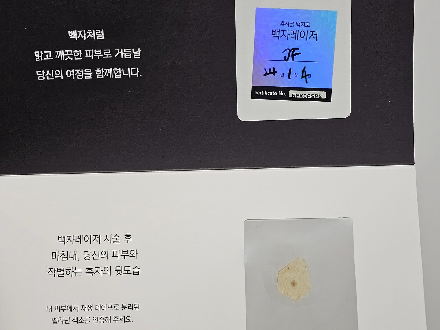 거뭇거뭇한 흑자 때문에 거울 볼 때마다 스트레스 받아서 이번에 백자레이저 받았어요!!

제가 얼굴에 흑자가 군데군데 있어서 카메라 어플이 아니라 피부 보정이 안 되는 일반 카메라로 찍으면 흑자가 보여서 스트레스 왕창🥹

요즘 릴스 찍는다고 일반 카메라로 동영상 찍는데 제 얼굴이 보기 싫어서 친구 따라서 피부과에 도움을 받았어요!!
상담할 때 직장인에 투잡까지 하고 있어서 많은 시간을 투자하는게 어려울 것 같다고 선생님께 말씀드리니 백자레이저 추천해 주시더라구요!!

백자레이저는 5분 만에 흑자를 뿌리까지 뽑을 수 있다고 해서 속는 셈 치고 받았더니 2주 후에 보니 아주 깔끔하게 쏙- 뽑힌거 있죠?!
이렇게 간편하게 스트레스 받았던게 머쓱해지는 순간이었어요ㅋㅋㅋ

색소 침착으로 스트레스 받는 분은 백자레이저 추천👍🏻

➕백자레이저 캠페인 이벤트에 당첨되면 선물 받을 수 있어서 나도 참여😆

#백자레이저 #리팟레이저 #리팟 #reepot #백자레이저캠페인 #백자캠페인 #흑자 #흑자제거 #밀크반점 #주근깨 #이벤트참여완료