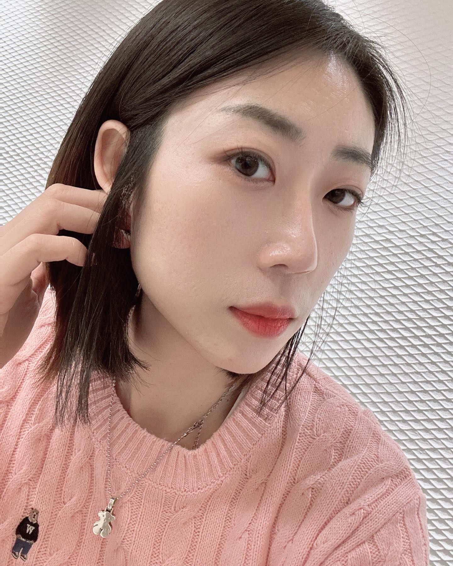 지난달! 바프 촬영 막바지를 앞두고
지독했던 다이어트의 결과로
볼살이 쏙 빠지고, 얼굴 볼륨이 사라져
거울 볼때마다 얼마나 우울했는지 몰라요~

그래서 피부과상담을 받고 관리를 시작했답니다 :)
유튭 피알남으로 유명한 원장님이 계시는 #보스피부과 에서
상담받고 콜라겐 생성촉진과 볼륨도 채워넣을수 있는
칼슘필러 #볼라썸 관리를 받았는데요.

상담실장님께서 앞볼과 팔자부분 볼륨이 많이 시급해보인다고 하셔서
2곳을 관리받았는데
신기하게도 1회차 관리가 끝나자마자
바로 차오른 볼륨감에 깜짝 놀랄정도에요!!

사실 마취크림도 좀 도톰하게 바를정도로
아팠던 시술이긴 하지만,
드라마틱하게 바로 변화된 모습에 흡족함 최고!!
주기적으로 쭉~ 관리받으러 다녀야 할것 같아요!!

#스킨부스터 #콜라겐스킨부스터 #청담동피부과 #청담피부과 #볼라썸 #볼라썸후기 #볼라썸스킨부스터 #스킨부스터추천 #보스피부과 #진주주사 #칼슘스킨부스터