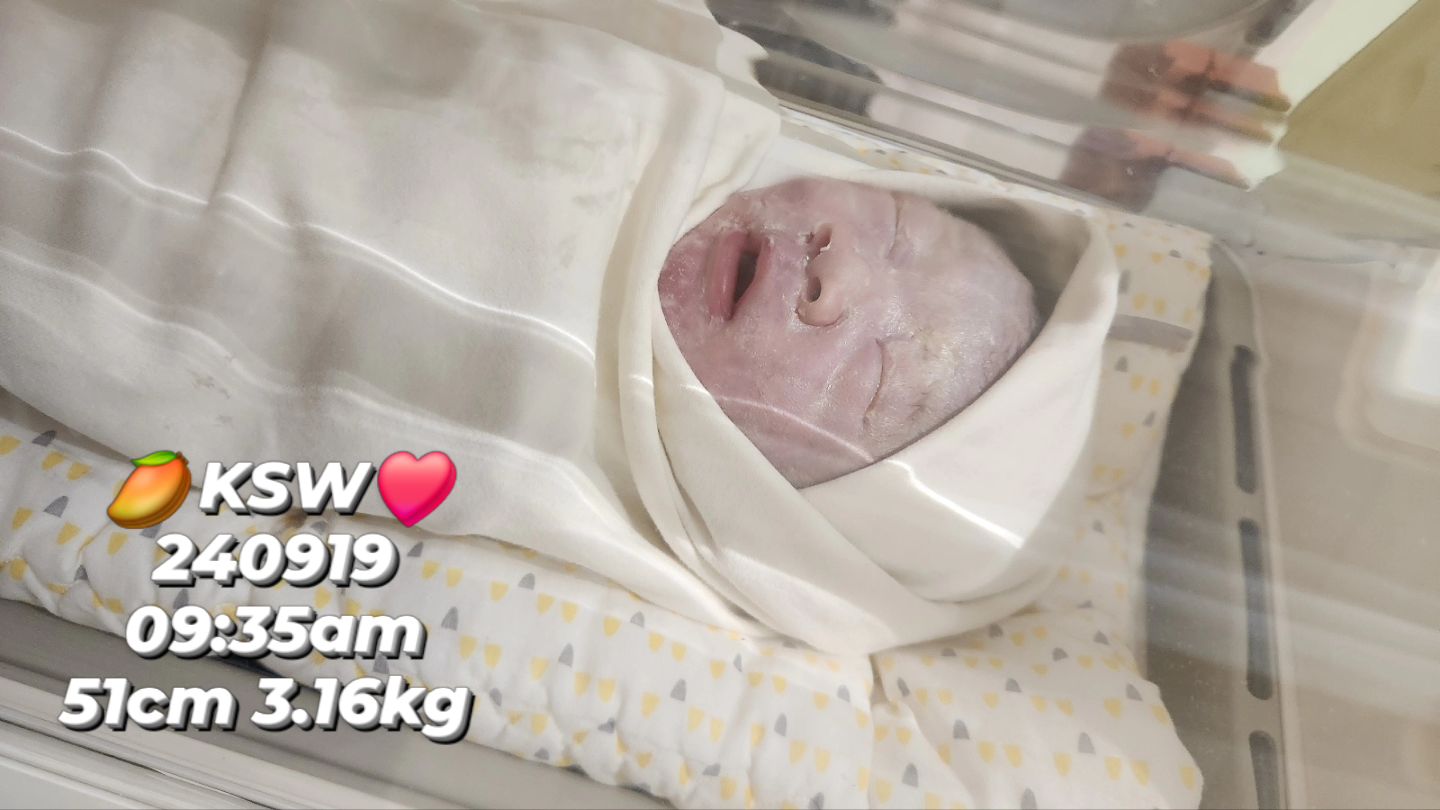 🥭
망고가 선우가 된 날!

세상 제일 사랑받는 엄마의
세상 제일 사랑스런 아들 선우야,

뽀얀 태지 가득한 너는
너무너무 작고 소중한 존재더라❤️

머리숱이 초음파에서부터 보인다더니
정말 까만 머리에 아빠를 빼다박은 코,
엄마닮은 발가락에 아빠닮은 갑빠까지ㅋㅋㅋ

어디하나 안이쁜데가 없네 내새킹🤭
엄마가 내일 꼭걸어서 보러갈게!

건강하자 우리선우!
엄빠 남은평생 지켜주께🤍🩵💙

#둘에서세명이된우리👪 
#엄마된날 #아들태어난날 #아빠된날