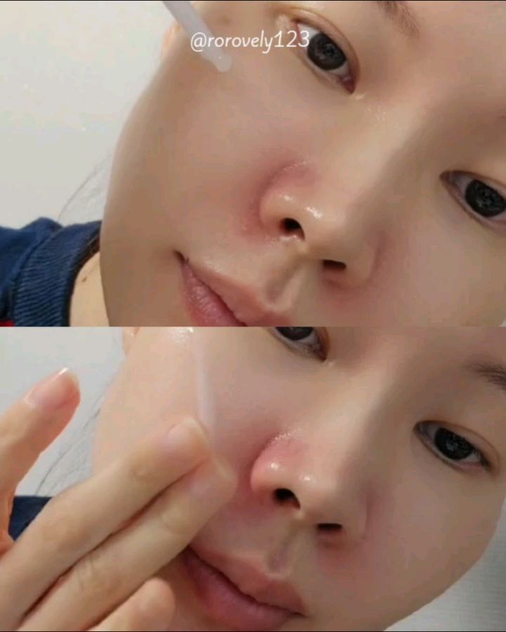 #협찬 
내 피부를 위해 아낌없이 사용 가능한 고기능 안티에이징 앰플이에요. 
내가 가지고있는 피부 고민을 해결할수 있는 써보니 아주 착한템이었답니다

미백, 주름 개선 이중 기능성 화장품으로 피부 자극 테스트를 만ㄴ족한 민감하고 예민쓰도 사용이 좋아요 보동 안티에이징은 레티놀 성분이 함유된 경우가 많은데 주름개선에는 도움을 주지만 자외선에는 아주 예민해서 지녁에만 사용하는게 좋아요 그렇지만 요건 레티놀의 단점을 보완한 성분인 바쿠치율을 담아내 주름개선으로 탄력까지 챙길수 있어요

 ✔️바쿠치올 10,000ppm + 나이아신아마이드 20,000ppm 함유 
✔️4가지 신체 적용 시험 완료

 보라빛이 매력적인게 너무 맘에 들어요. 
꾸준하고 꼼꼼하게 챙겨 바르게 되는 앰플이랍니다.
주름 개선 뿐 아니라, 7검 히알루론산, 락토바실러스, 소이밀크발효여과물 성분으로 피부 보습을 나이아신아마이드, 비타민 C 유도체 성분으로 피부 미백까지 챙겼어요

촉촉하고 부드러운 제형으로 즉시 느껴지는 감촉과 수분감에 만족스러웠답니다. 
이게 까다롭기로 유명한 화해 설문단 앰블럼 획득을 한 제품으로 사용감 만족도 98%
그러니 안챙겨갈수가 없답니다.

#블리블리 #VELYVELY #리뷰블리 #안티에이징앰플 #주름앰플 #미백앰플 #바쿠치올앰플
  #바쿠치올세럼 #리프팅앰플 #대용량앰플 #cosmetics #skincare #kbeauty #beauty