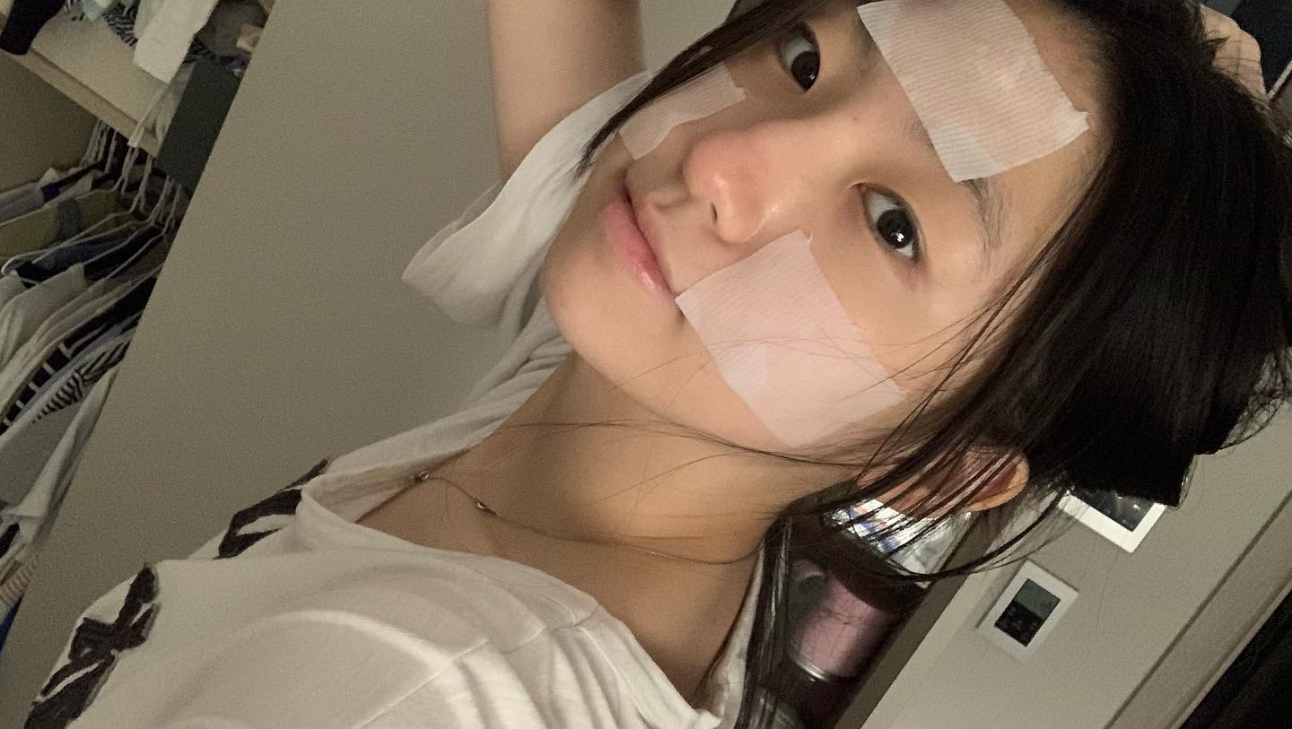 #협찬 bioheal.boh_official 

강한 자외선과 피부를 스치는 바람 , 땀 피지 등 외부 자극이 피부가 얇아지고 민감해지는 근본적인 원인임미다 🥲 판테셀™ 리페어시카 거즈 패드로 진정진정 ! 수분을 잔~뜩 공급해주자구요 🍃🫶

#협찬 #피부장벽 #피부장벽강화 #판테셀패드 #민감성피부 #얇은피부