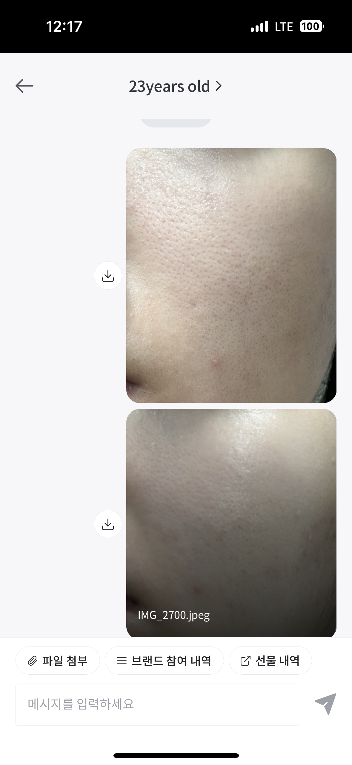 [23years old] 깐달걀크림 바데카실P