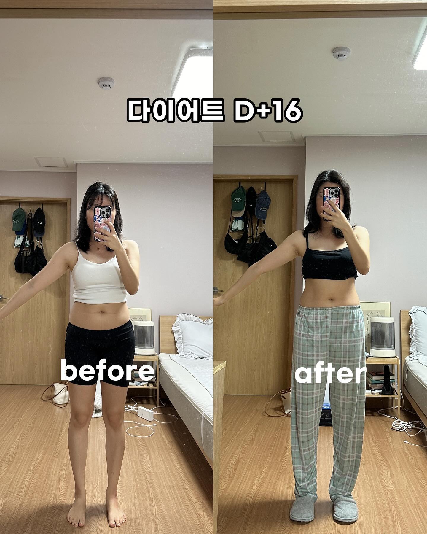 #다이어트16일차

슬로우 다이어트 지만 여름을 위해 지금부터
순항중인 저의 다이어트!!😎👙

눈앞에 유혹을 뿌리치지 못하고 ,,ㅎㅎ
어제도 돌찬치 가서 생맥🍺에 맛있는거
잔뜩 먹고 왔는데 그만큼 배출이 👍ㅋㅋㅋㅋㅋ

1일차 부터 지금까지 쭉 딥트3일과 함께 하고 있는데
아침에 애플번 2알, 자기전 피치맛번 1알 챙기고
스트롱업이랑 슈퍼패스트는 양심에 찔리는,,,,?
음식 먹을때만 필수로 먹고 있어서 매일 먹지는 않아요❌

적절하게 활용하기!!🙋🏻‍♀️

평소 관리는 = 애플번, 피치맛번
특별 관리는 = 스트롱업, 슈퍼패스트

참고 하셔서 관리 하세요~!!😎

⏰ #딥트3일 공구 24일 마감
🎁 1월 공구 구매자 이벤트 진행중! 구매 dm인증 후
프로필링크 이벤트란 참여 해주세요
올리브영 5만원, 스타벅스 기프티콘을 드립니다.

.
.

#딥트3일솔직후기 #딥트3일스트롱업 #딥트3일피치맛번 #다이어트기록 #다이어터소통 #다이어트눈바디 #2주다이어트