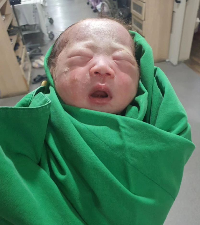 2024.08.11 AM 10:37  3.35kg 51cm 👶
역아라서 16일에 수술날짜도 잡아났는데,
아빠생일에 같이 미역국 먹고싶어서 
아빠생일 아침에 양수 터져버린 찰봉이🤭
수술은 몇 번 만지고 누르는 것 같더니 아기가 나왔고,
귀찮아하는 고양이 울음소리가 들렸다ㅎㅎ이게 맞나??
그리고 예상대로 너무 못생겼는데,
그나마 오늘 좀 덜 못생겼다😂 
차차 이뻐지길 바라.. 진짜 쪼꼬만한 쪼꼬미..
잘지내보쟈😍