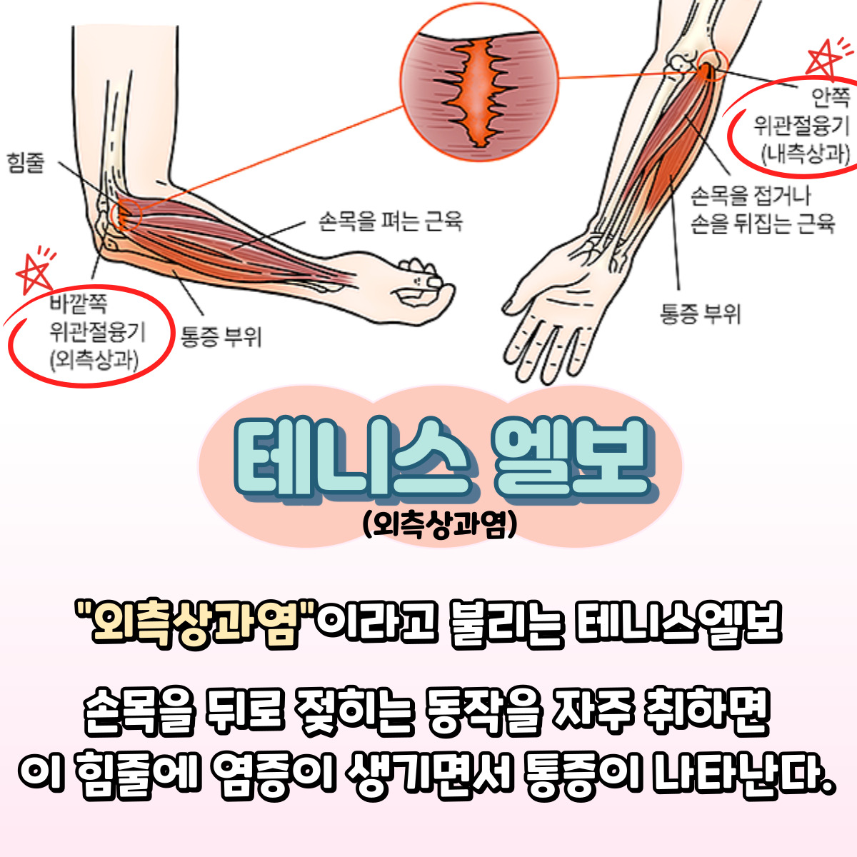 콘텐츠