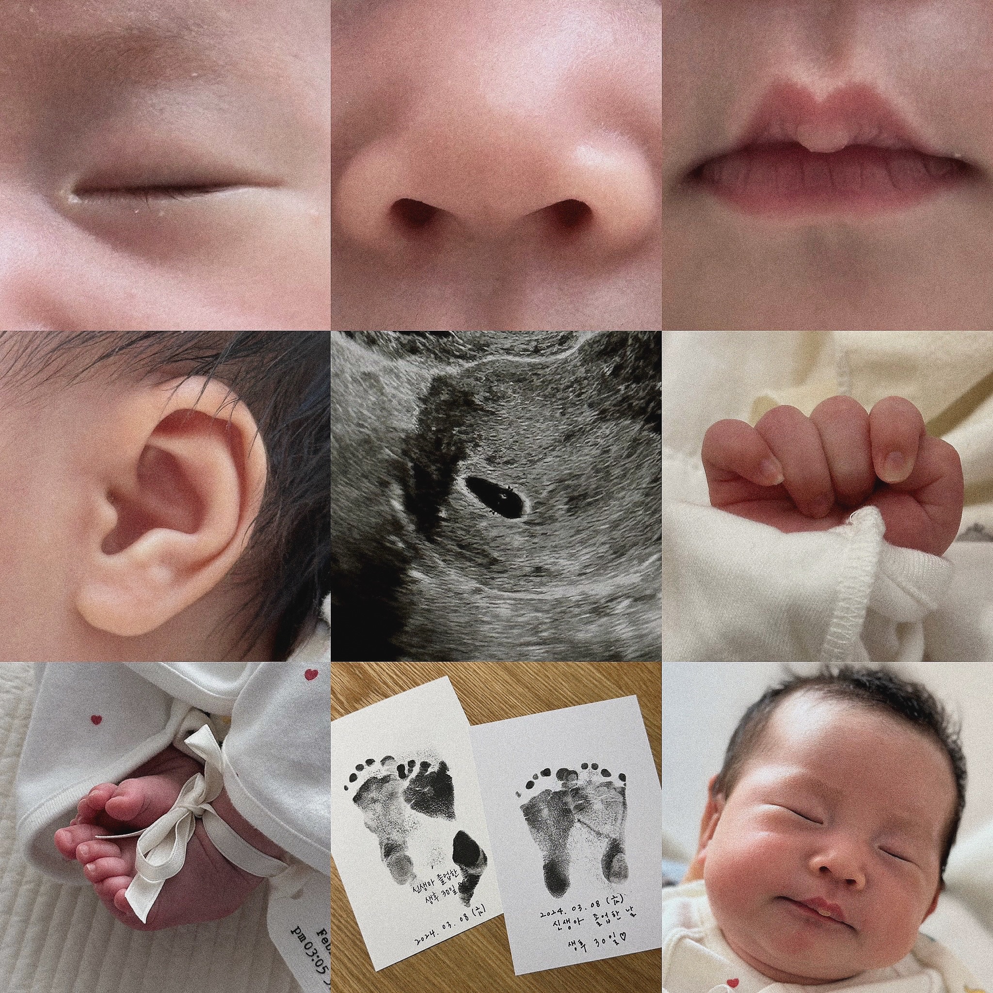 👼🏻+30일 , 이서 신생아 졸업 🤍

어느 날 엄마 배에 까꿍 ! 하고 찾아와서 열달동안 까꿍이로 무럭무럭 건강하게 자라 , 이서로 태어난지 벌써 30일 ...
30일동안 아픈곳 없이 건강하게 자라줘서 고맙고 사랑해 이서야 🫶🏻 앞으로도 건강하게 엄마 아빠랑 잘 지내보자 !

이서 신생아 졸업 축하해 👼🏻🤍